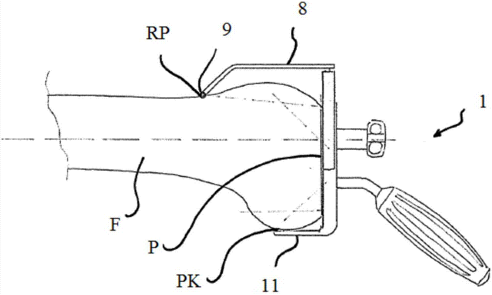 Jig for determining a patient-adapted implant size of the femoral implant of a knee endoprosthesis