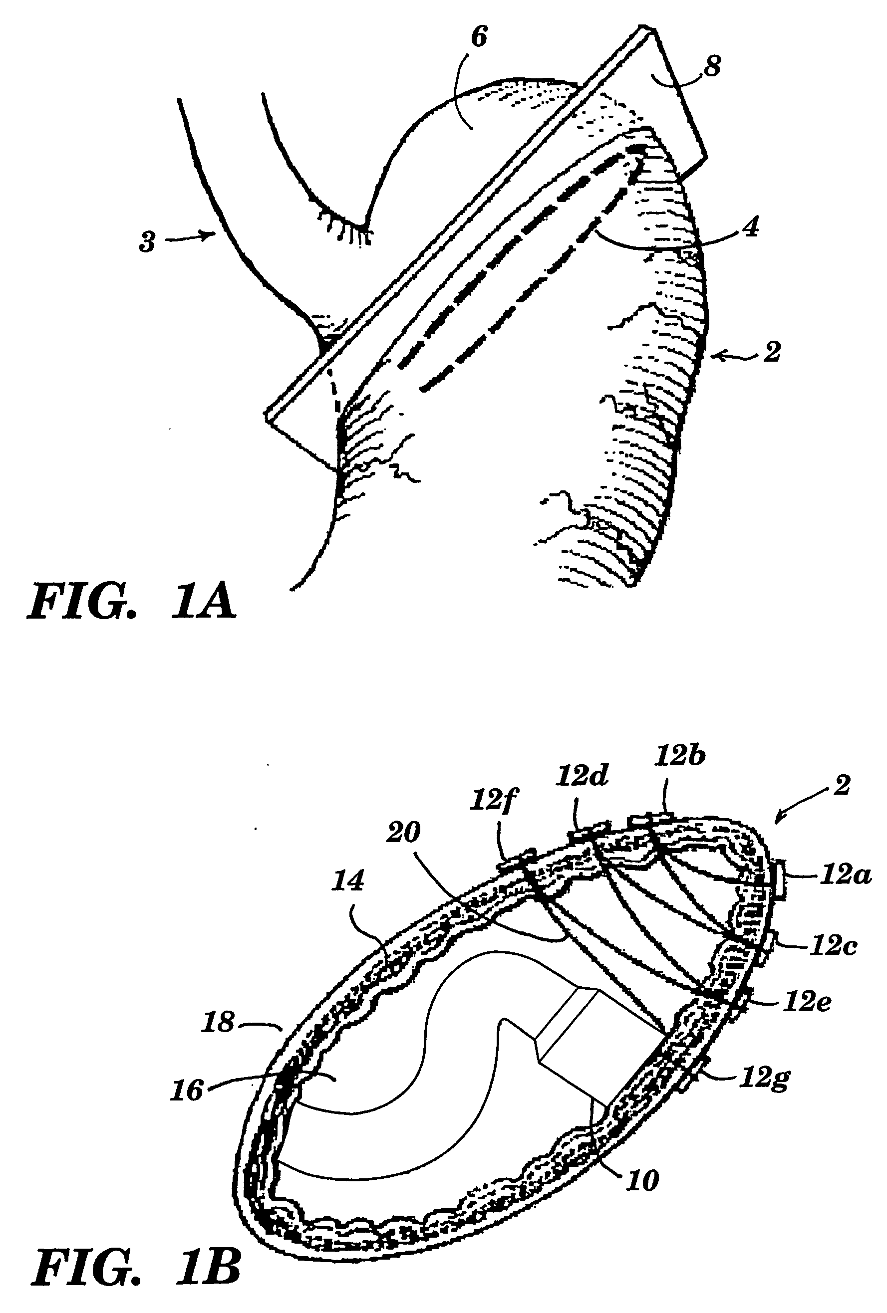 Suturing Devices and Methods