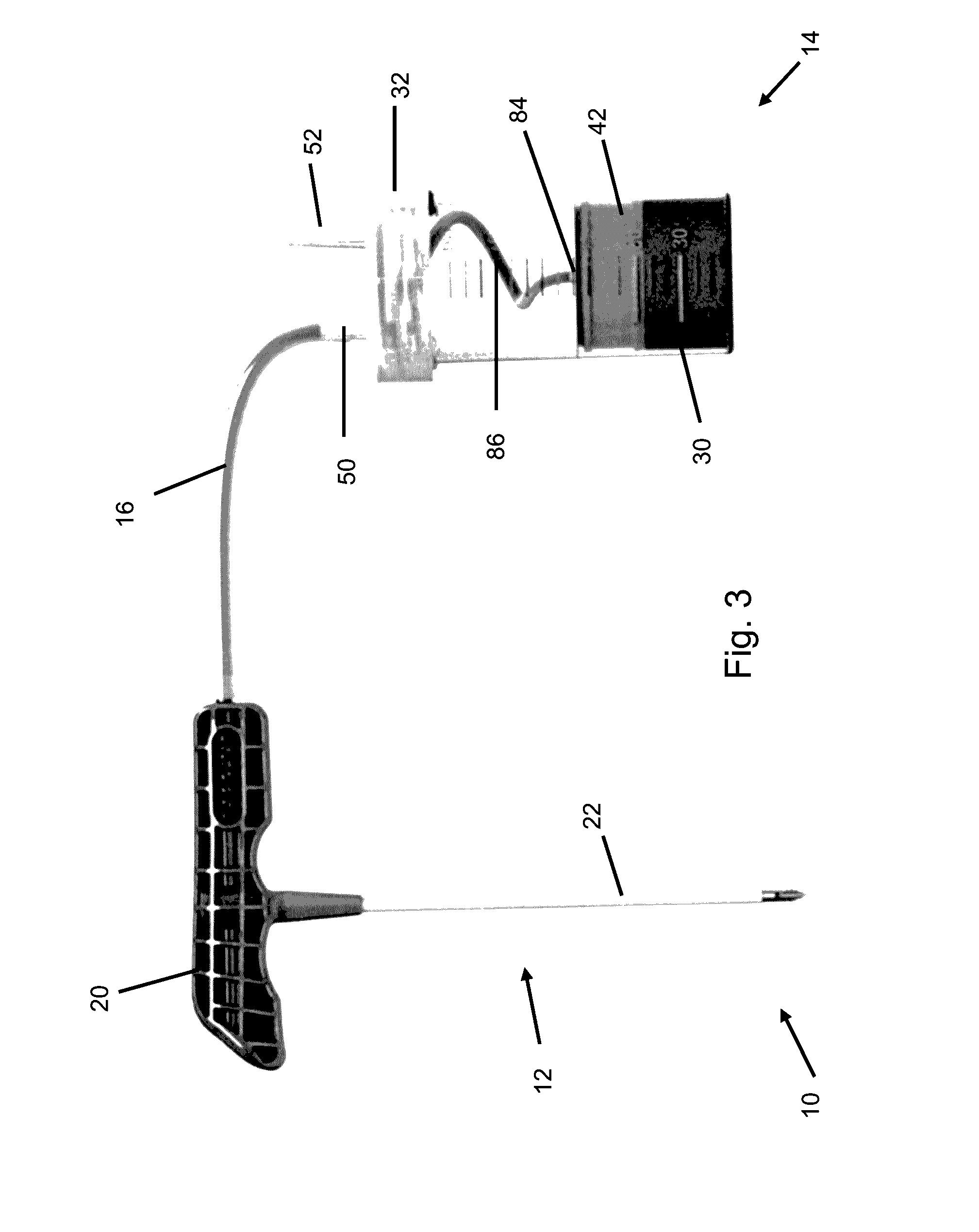 Bone fragment and tissue processing system
