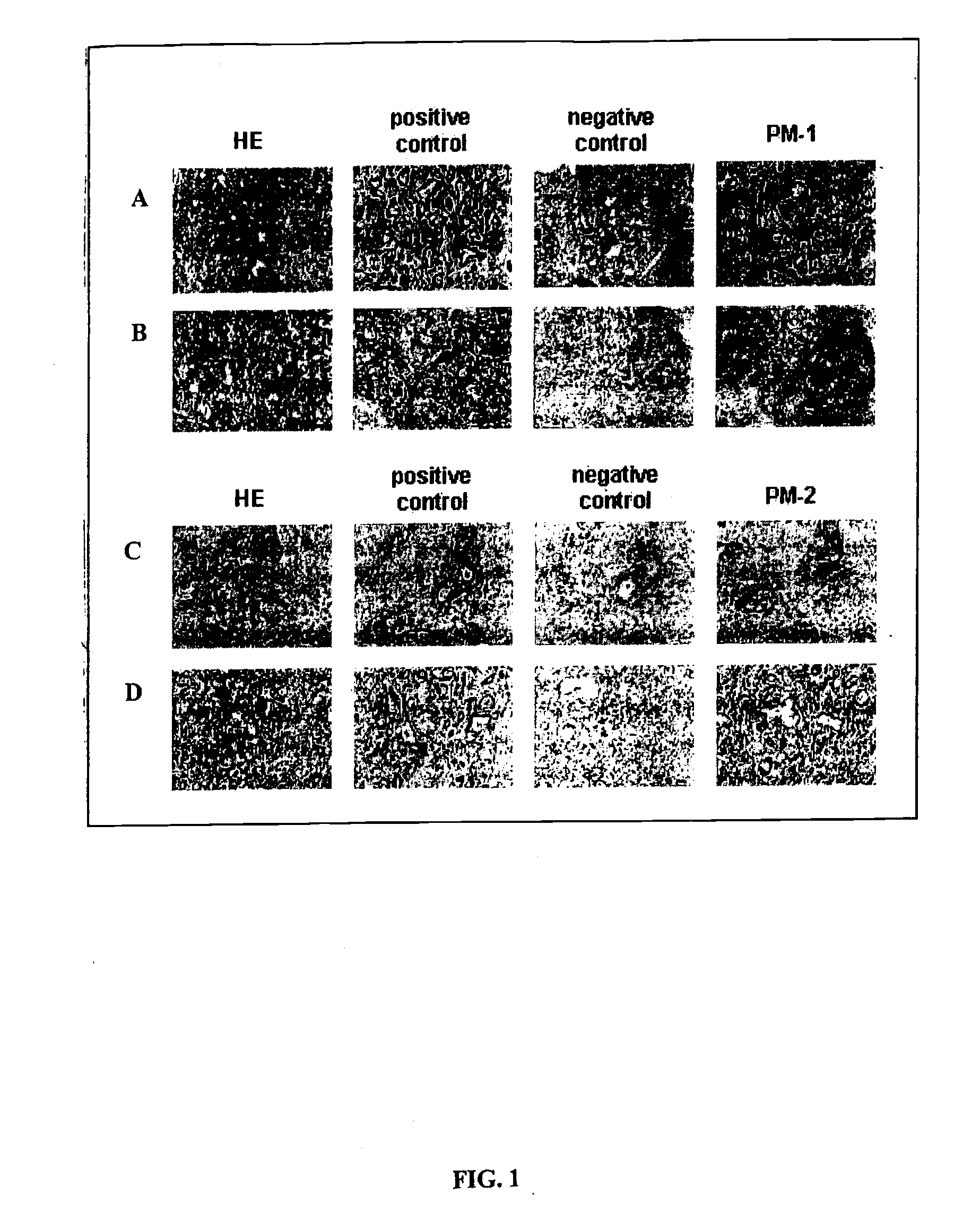 Neoplasm specific antibodies and uses thereof