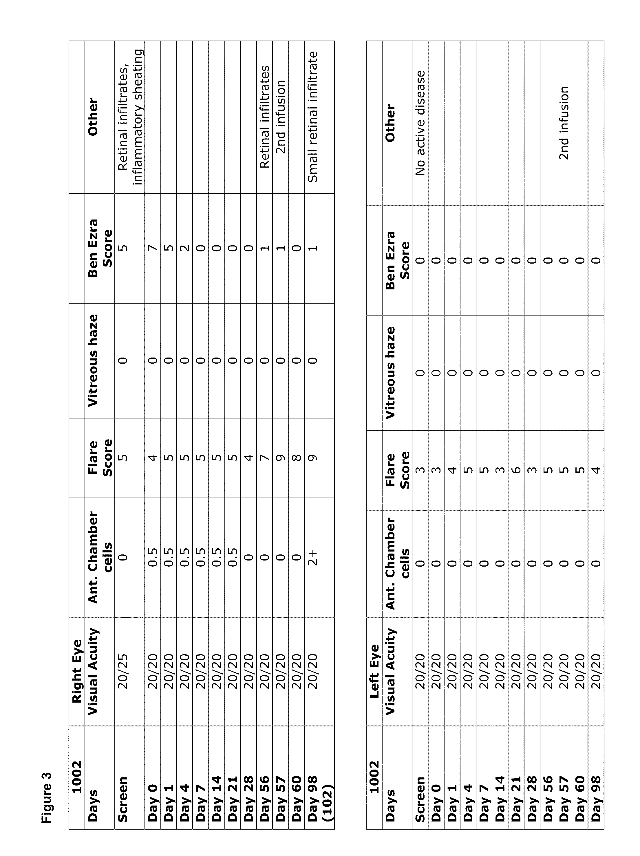 Methods for the treatment of il-1beta related conditions