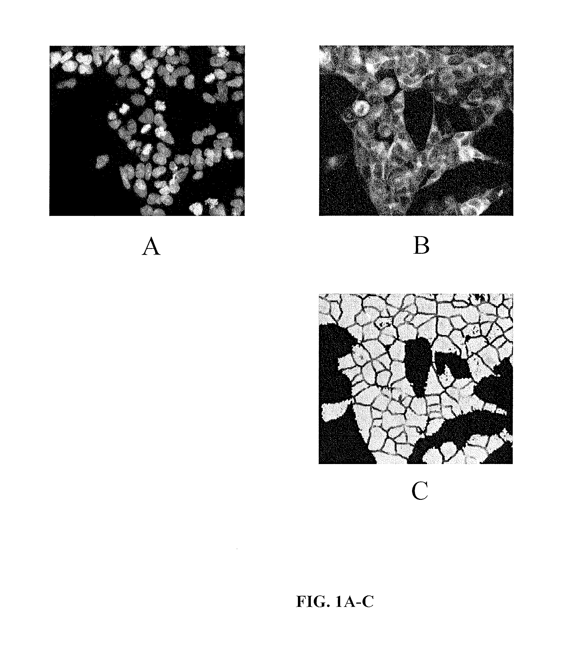 Pyrazolopyridazines and methods for treating retinal-degenerative diseases and hearing loss associated with usher syndrome