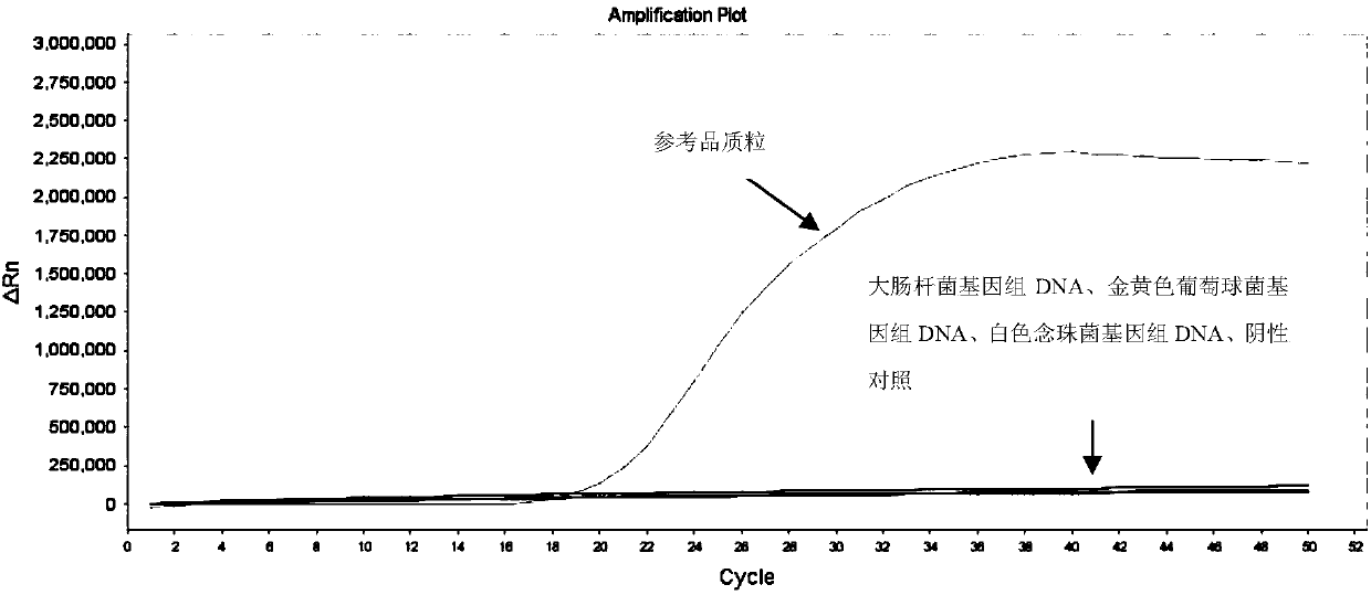 LAMP primers for detecting mycobacterium tuberculosis in intraocular fluid and application thereof