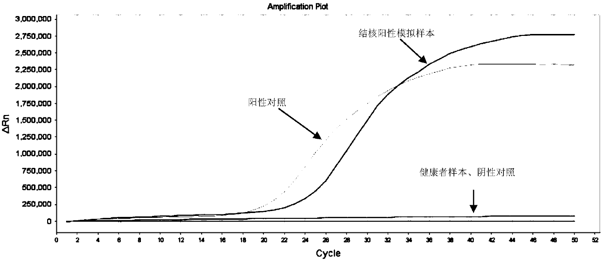 LAMP primers for detecting mycobacterium tuberculosis in intraocular fluid and application thereof