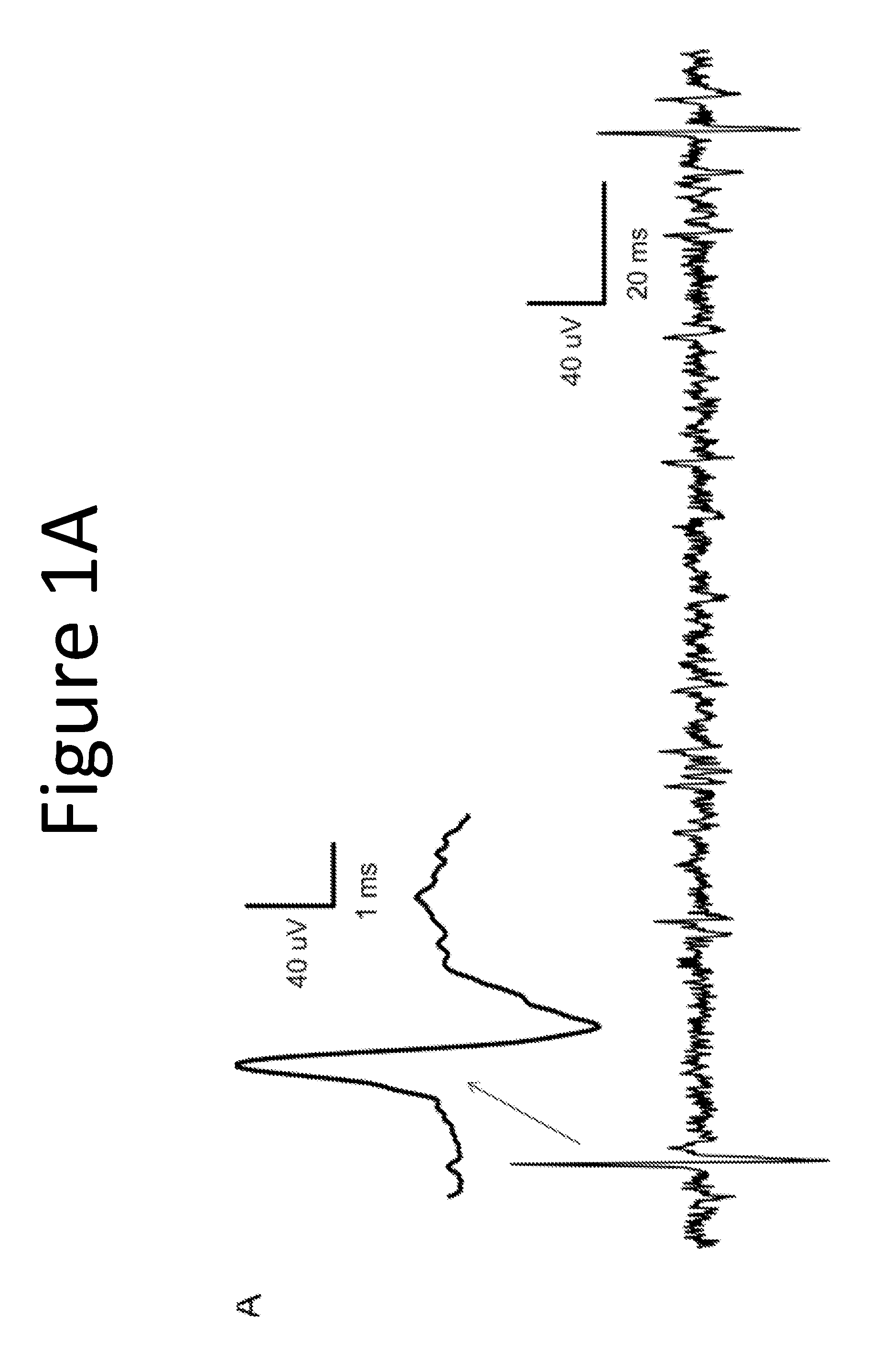 Methods and compositions for stimulation of the intestinal enteroendocrine system for treating diseases or conditions related to the same