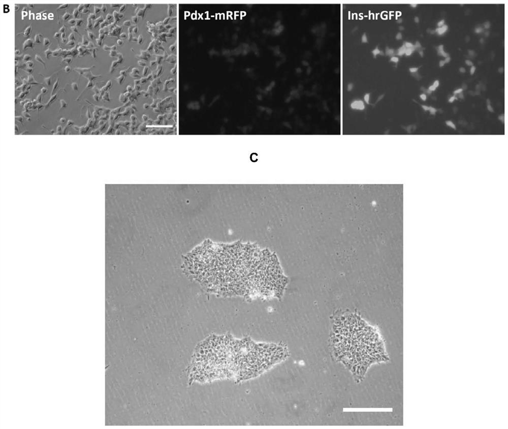 Construction and application of induced pluripotent stem cell line expressing pdx1/insulin dual reporter gene