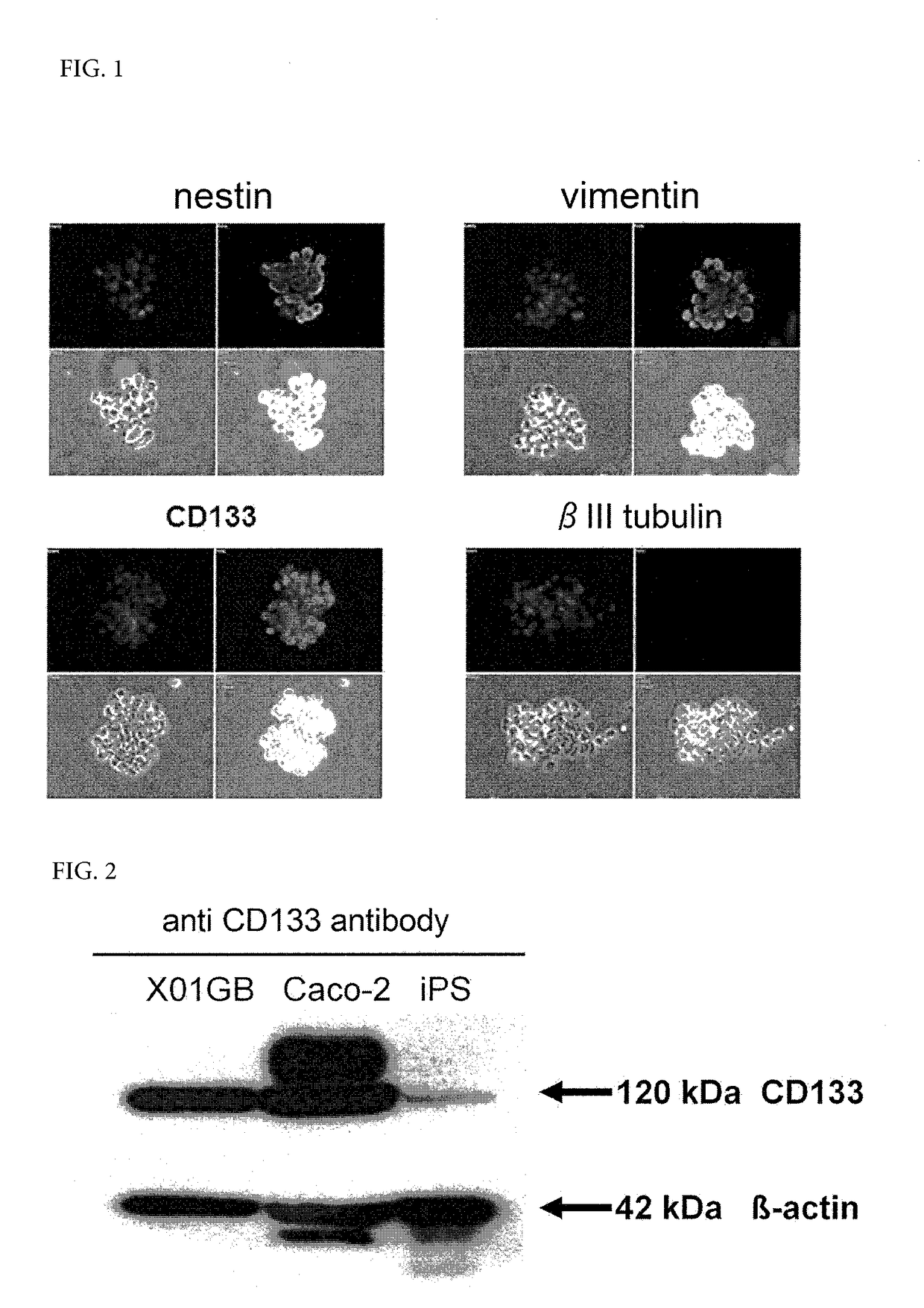 Viral vector targeting cancer stem cells