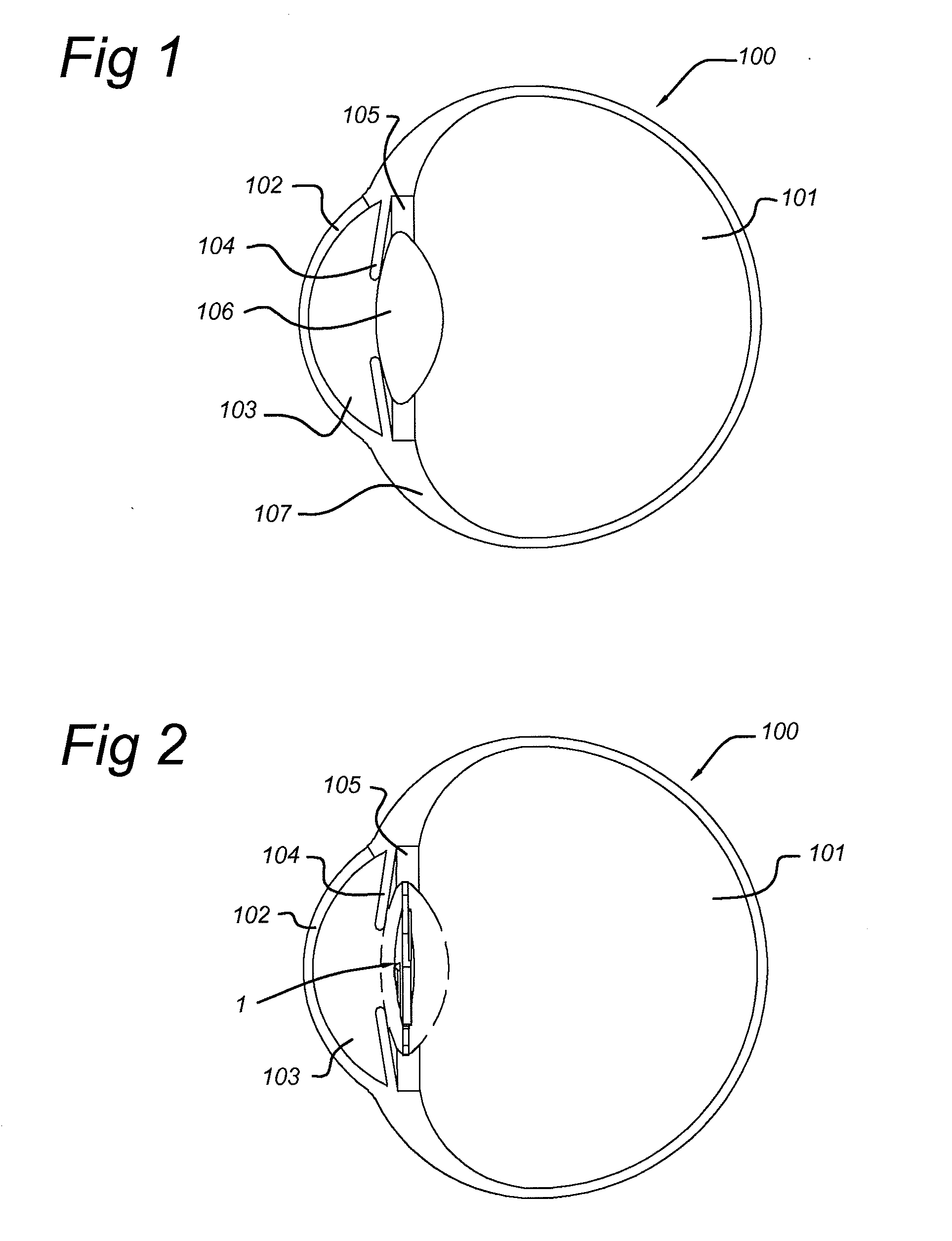Ophthalmic lens with optical sectors
