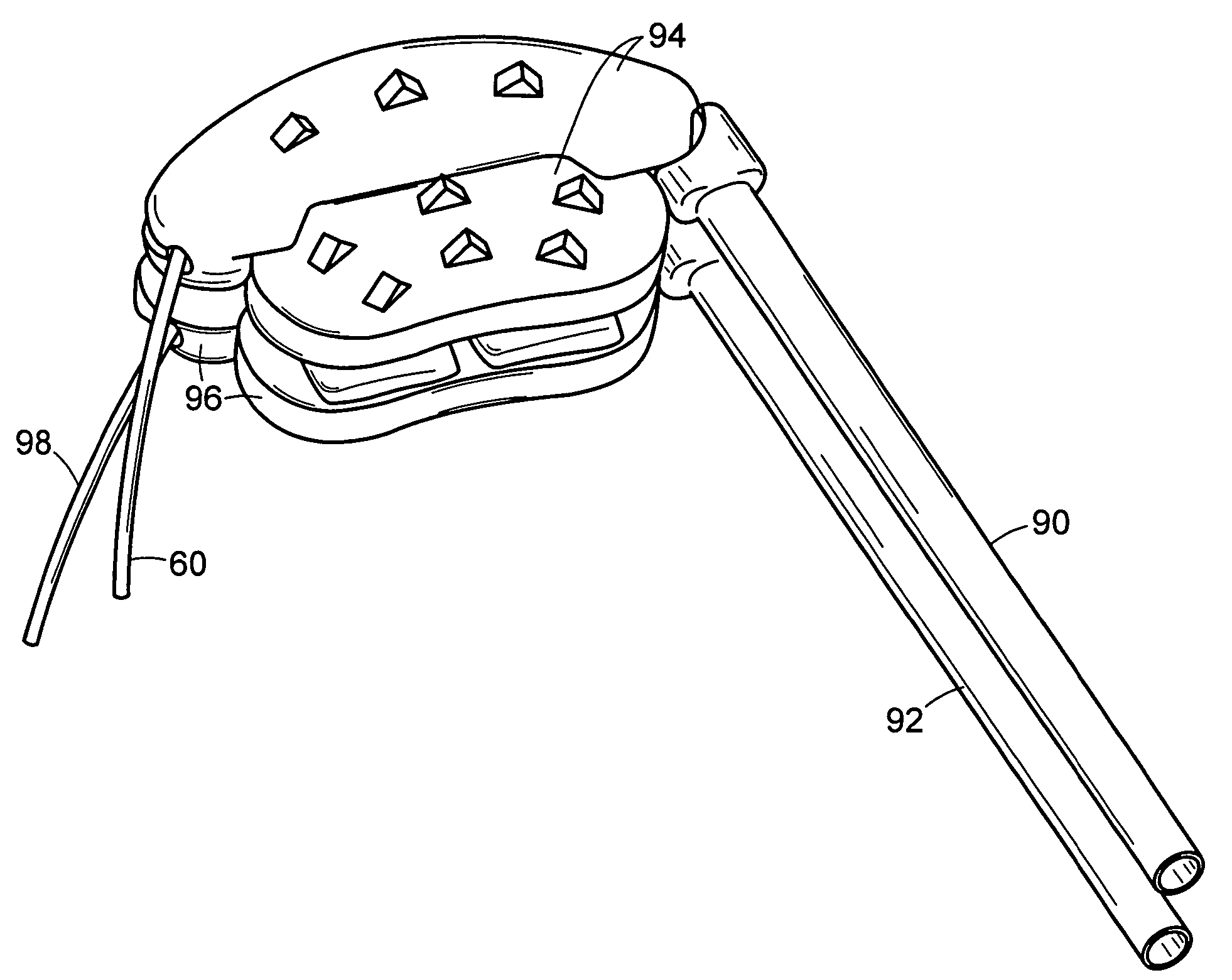 Intervertebral prosthetic disc and method for installing using a guidewire