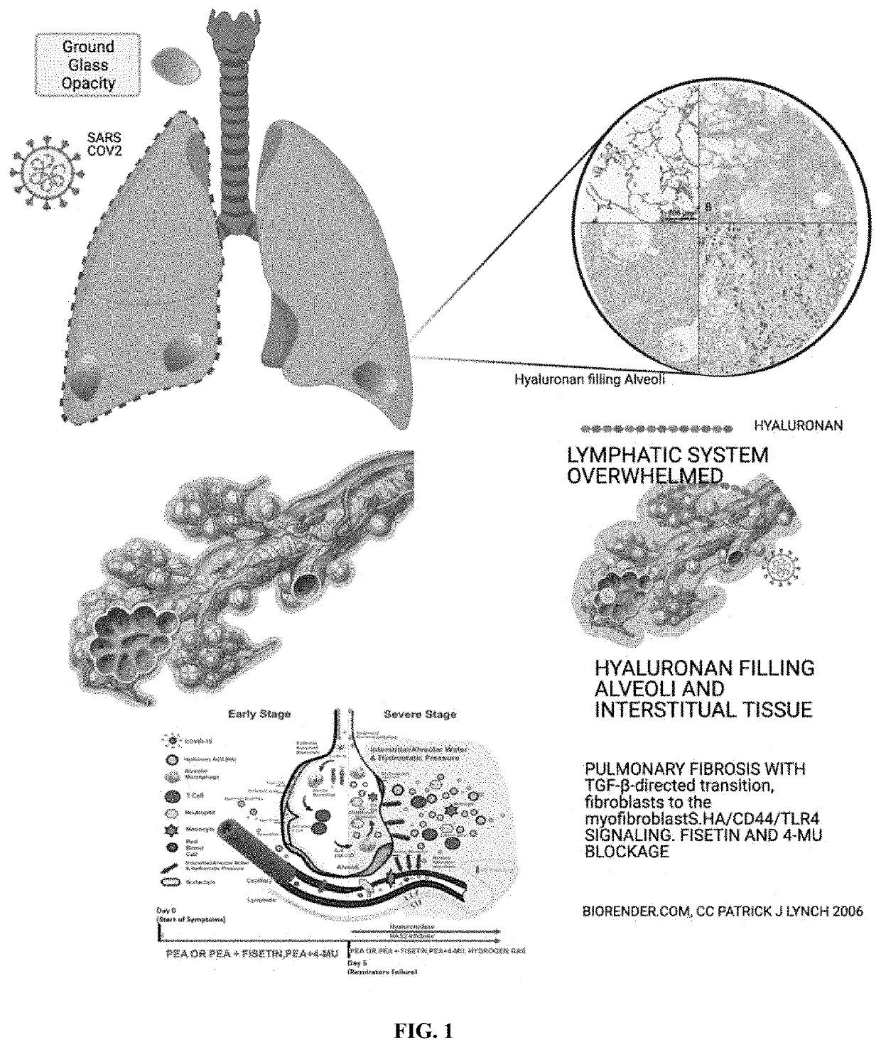 Systems and methods for treating coronavirus