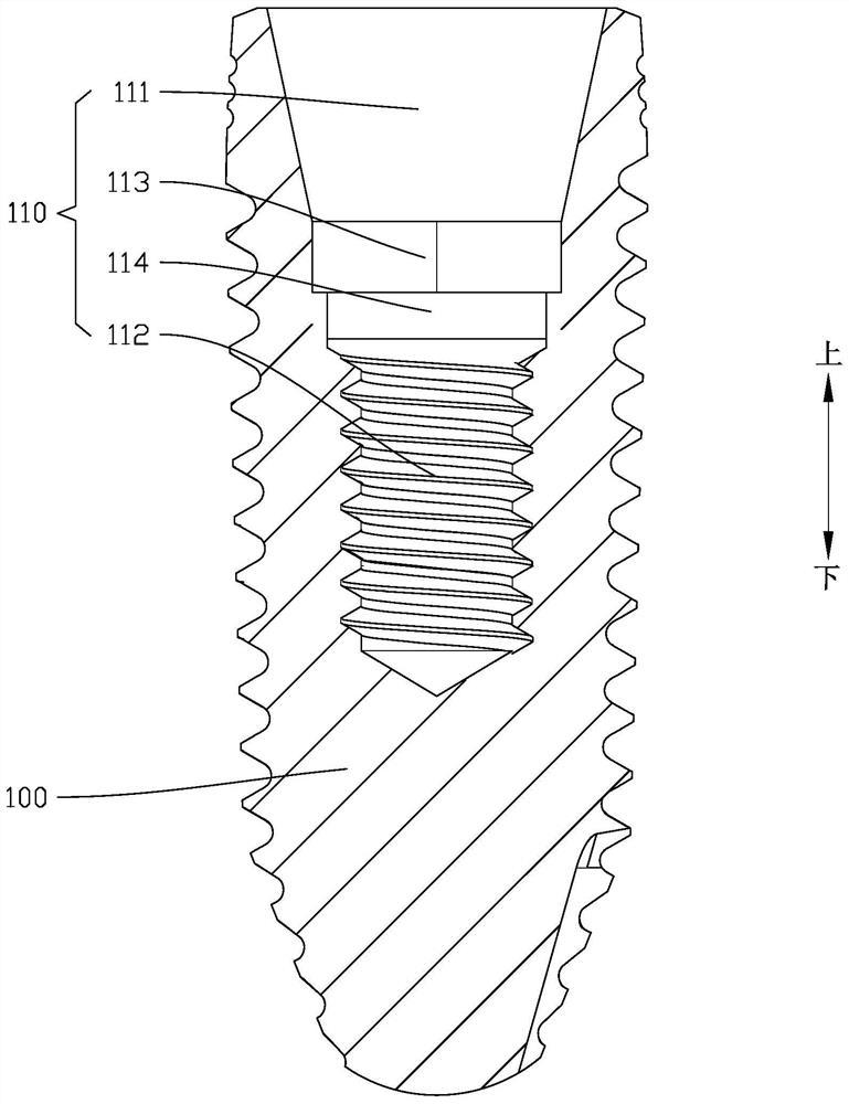 Double-sided fusion connected dental implant assembly