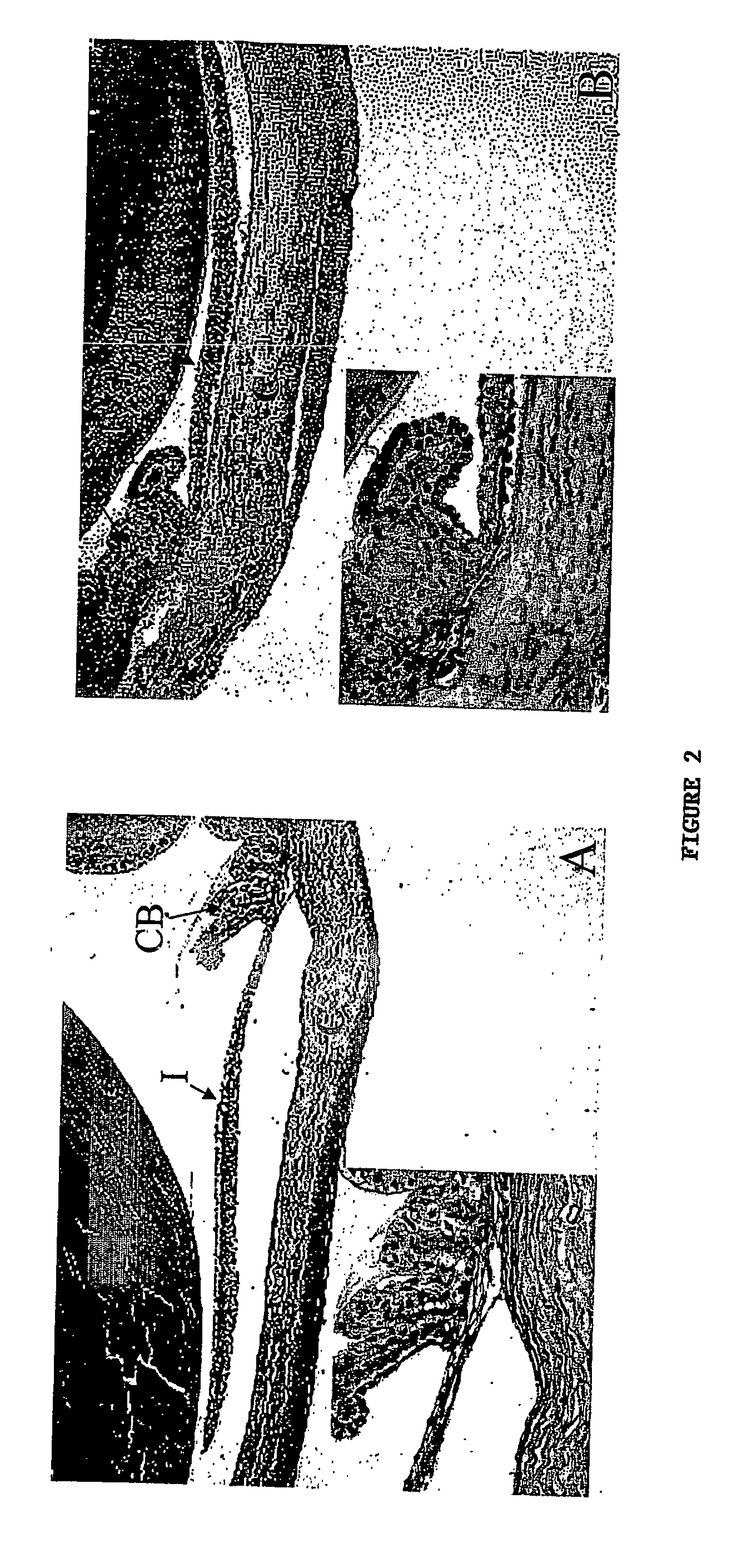 Methods for Treating Ocular Inflammation by Neutralizing Cxcl10 Activity