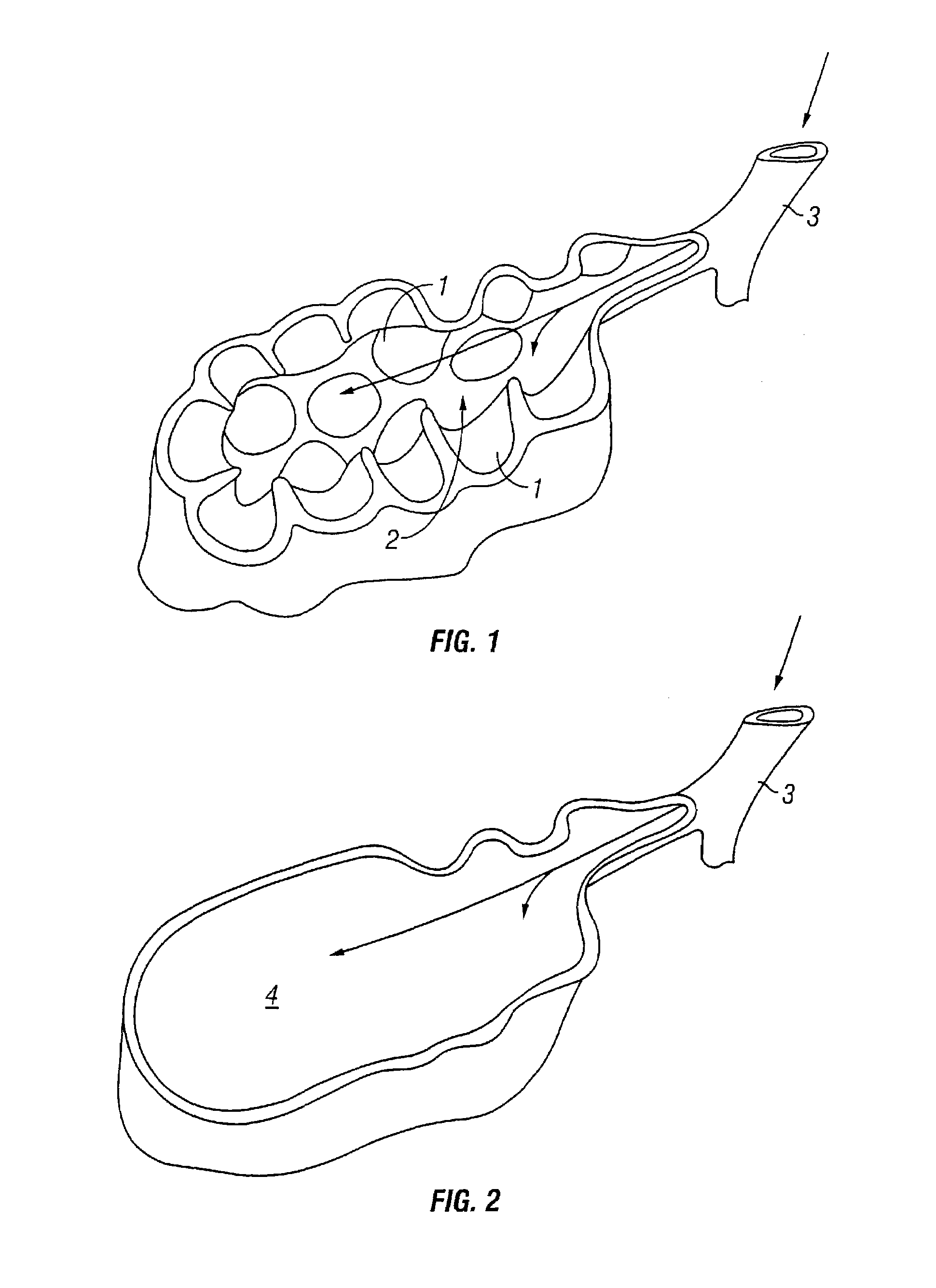 Method of increasing gas exchange of a lung
