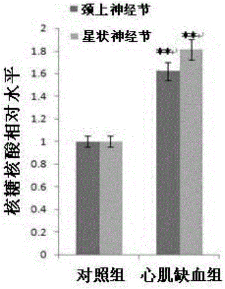 Use of NONRATT021972 small interfering RNA in preparation of drug for treating myocardial ischemia injury and sympathetic nerve diseases