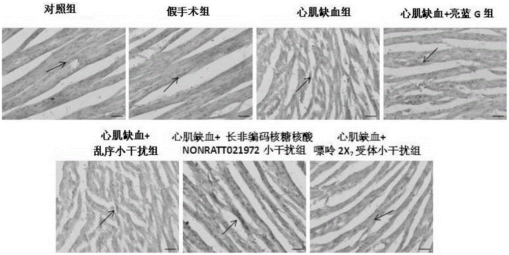 Use of NONRATT021972 small interfering RNA in preparation of drug for treating myocardial ischemia injury and sympathetic nerve diseases