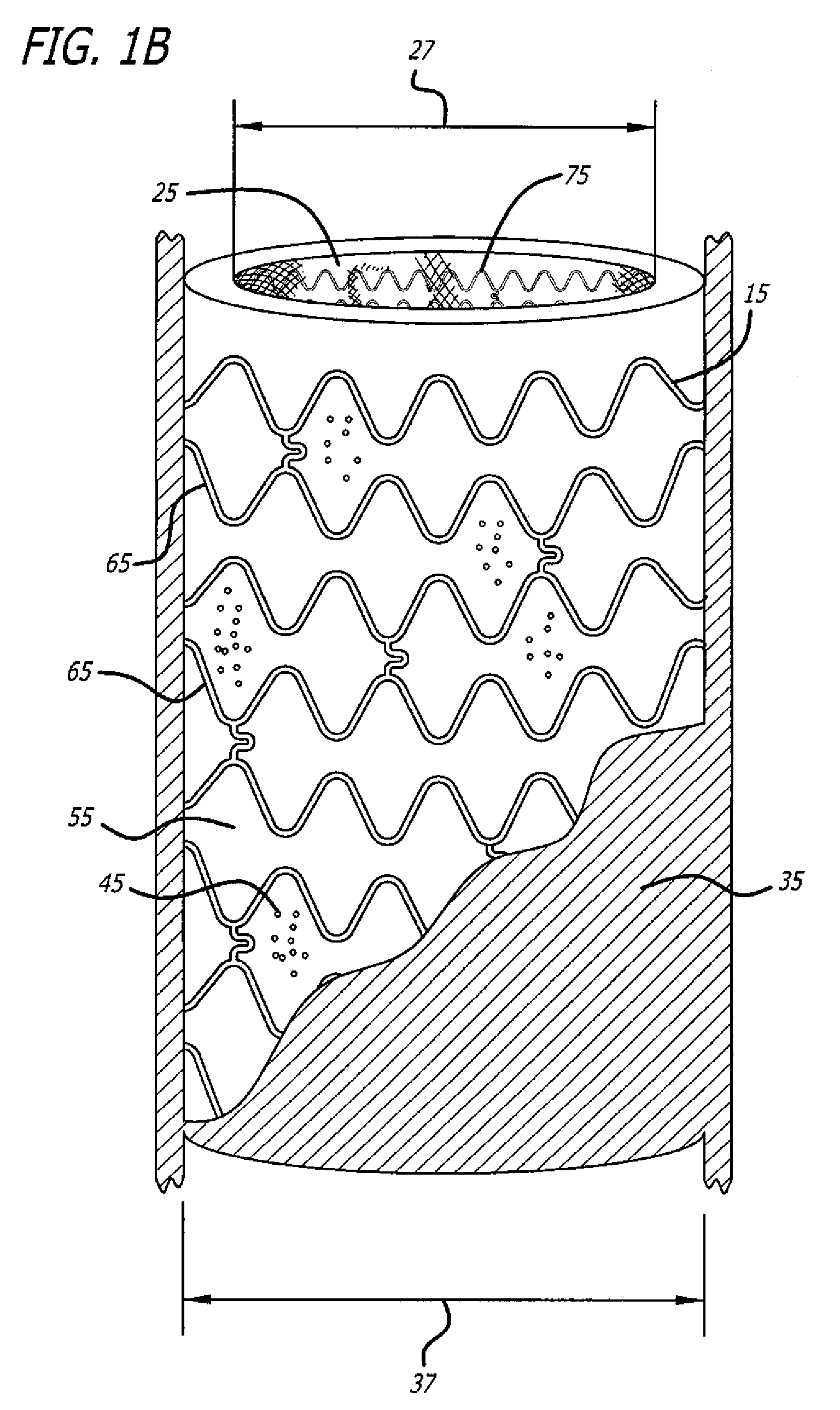 Intravascular Devices for Cell-Based Therapies