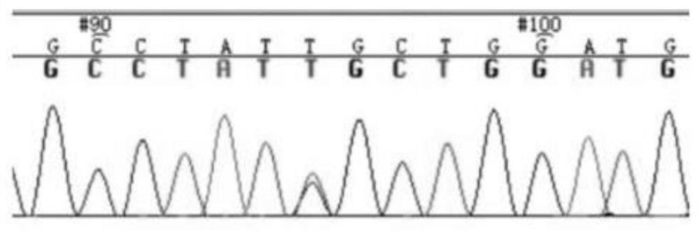 Immortalized cell line of human jugular paraganglioma and its application