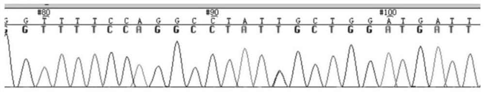 Immortalized cell line of human jugular paraganglioma and its application