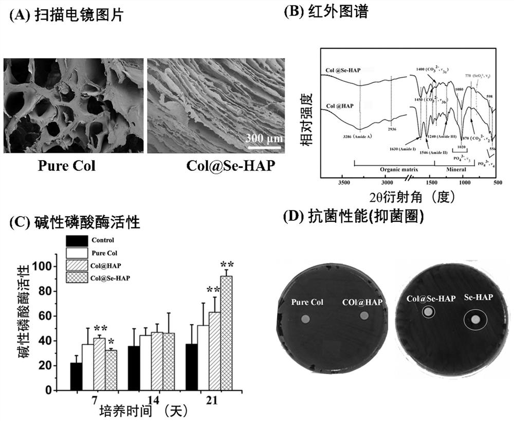 Selenium-doped hydroxyapatite nano-enhanced collagen GBR membrane and preparation method thereof