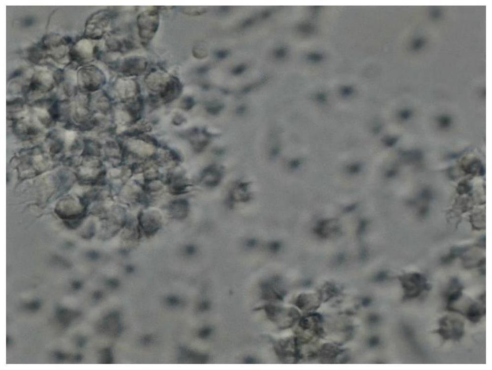 Co-culture method for in-vitro activation of DC cells through heat shock protein gp96-polypeptide complex