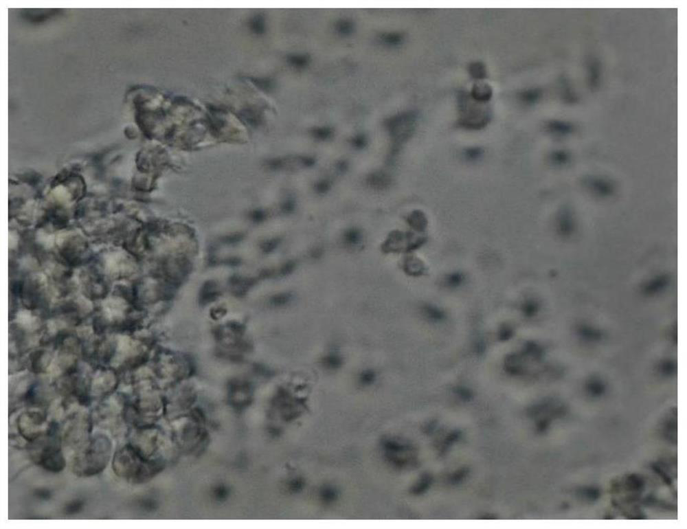 Co-culture method for in-vitro activation of DC cells through heat shock protein gp96-polypeptide complex