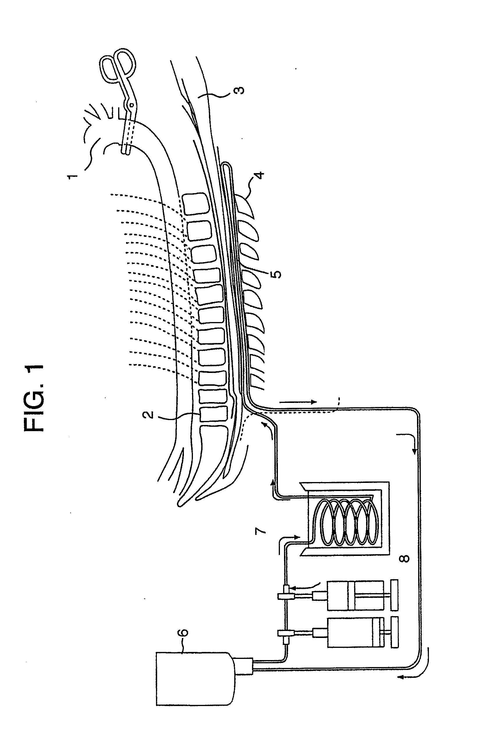 Catheter for Topical Cooling and Topical Cooling Device using the same