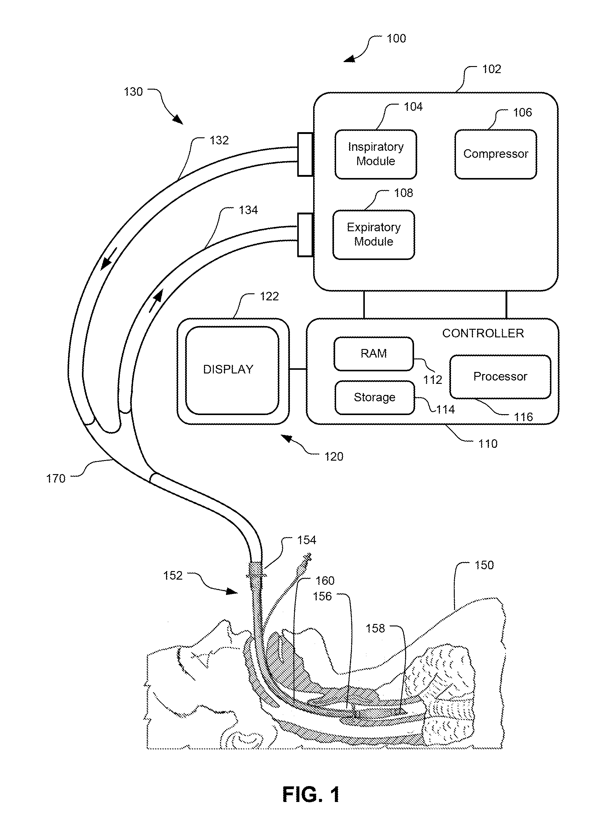 Method And System For Generating A Pressure Volume Loop Of A Low Flow Recruitment Maneuver