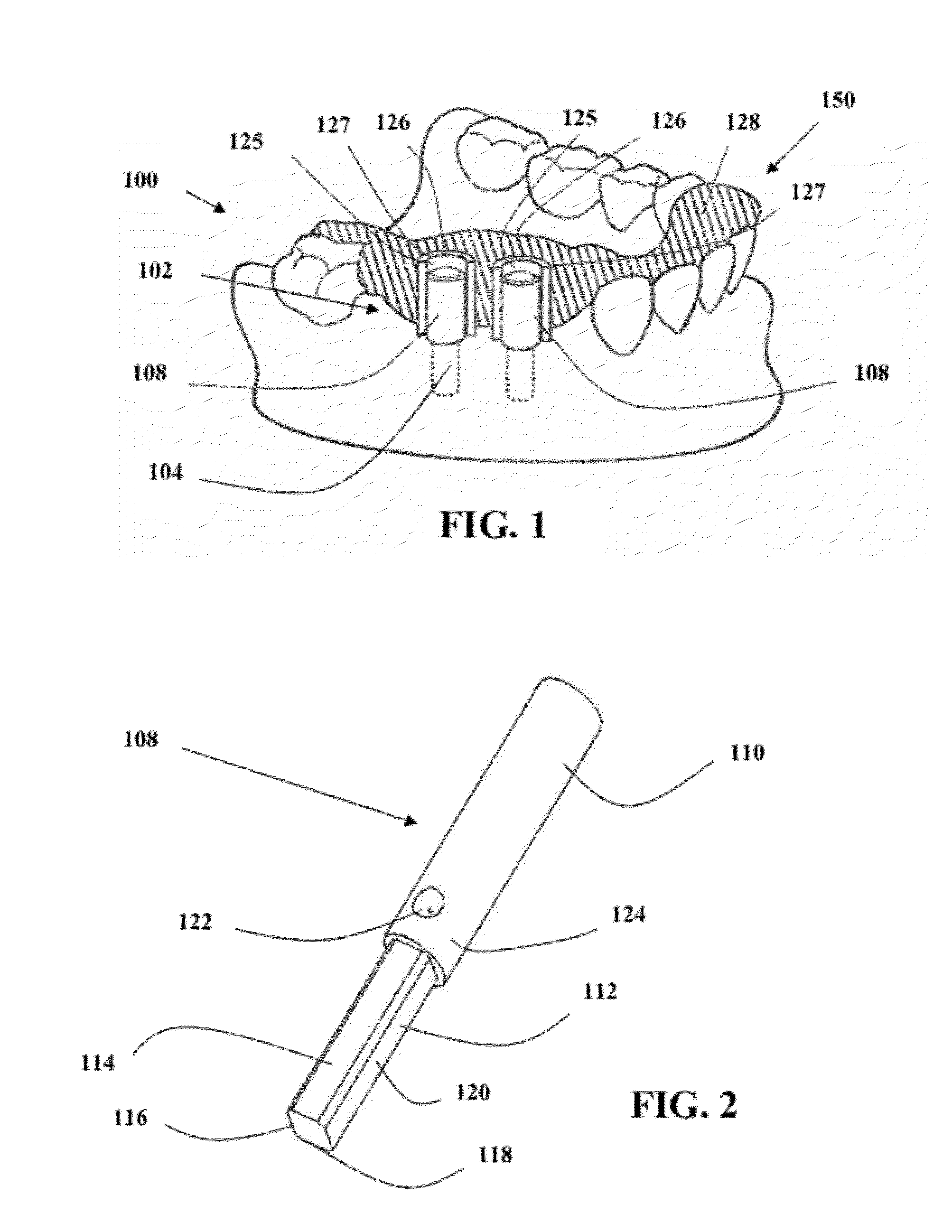 Method and apparatus for bending a guide post used in forming a template for locating a dental inplant hole