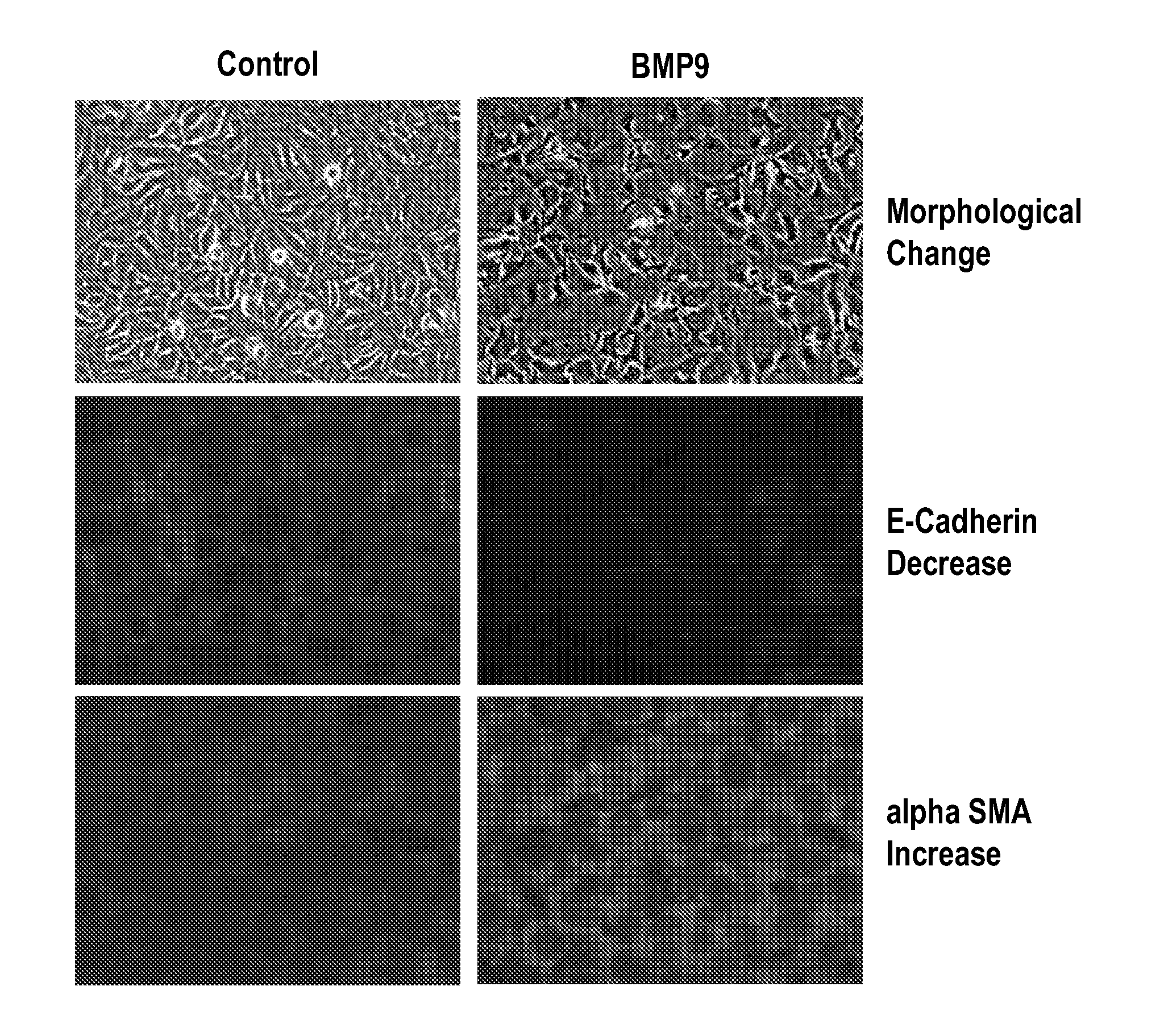 Diagnostic biomarkers for fibrotic disorders