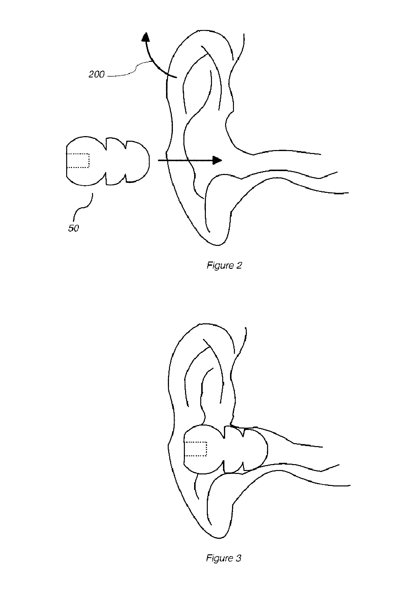 Novel hearing protection device and method and secure earbud assembly