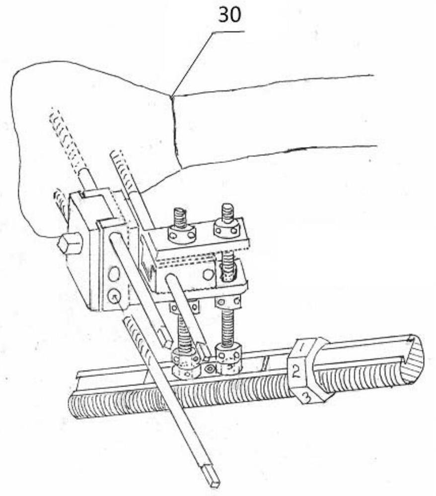 Mechanical dual-upper-limb dynamic comprehensive restoration of multi-segment bone deformity external fixation bracket