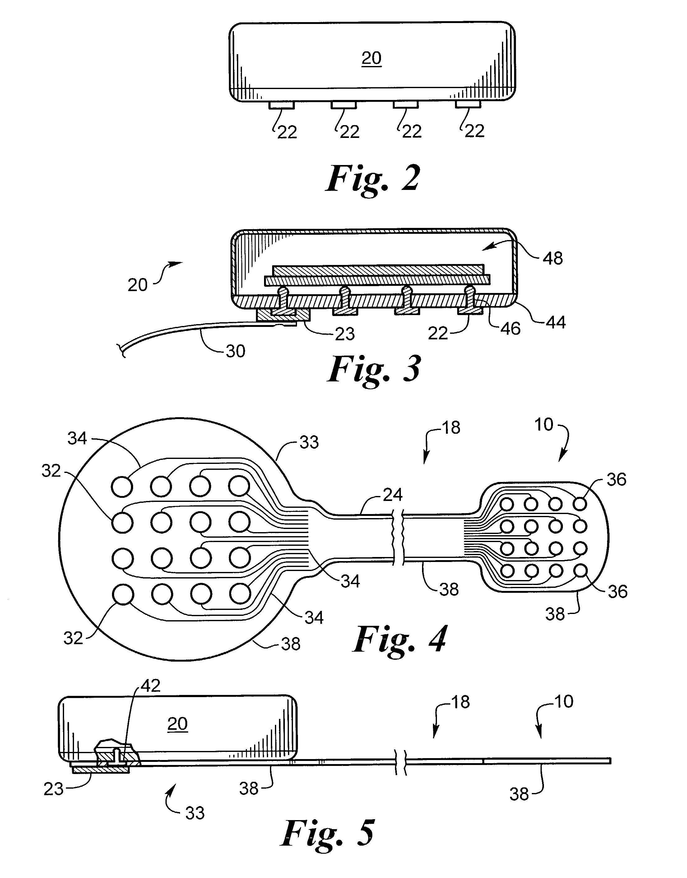 Biocompatible bonding method and electronics package suitable for implantation