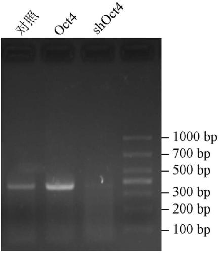Application of oct4 in regulation of IL-31 gene expression