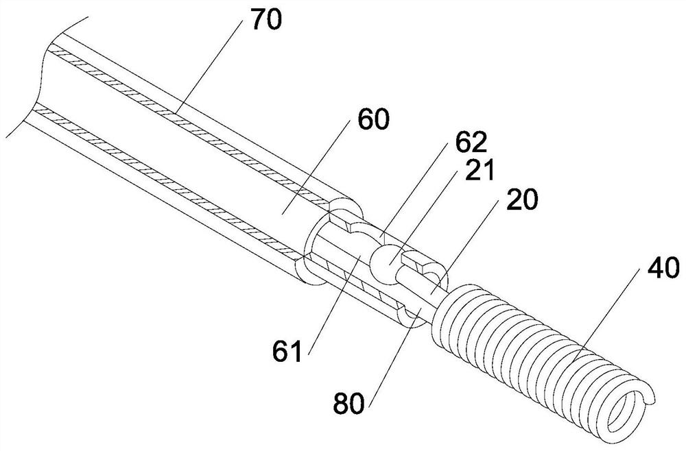 Vascular embolism spring ring system