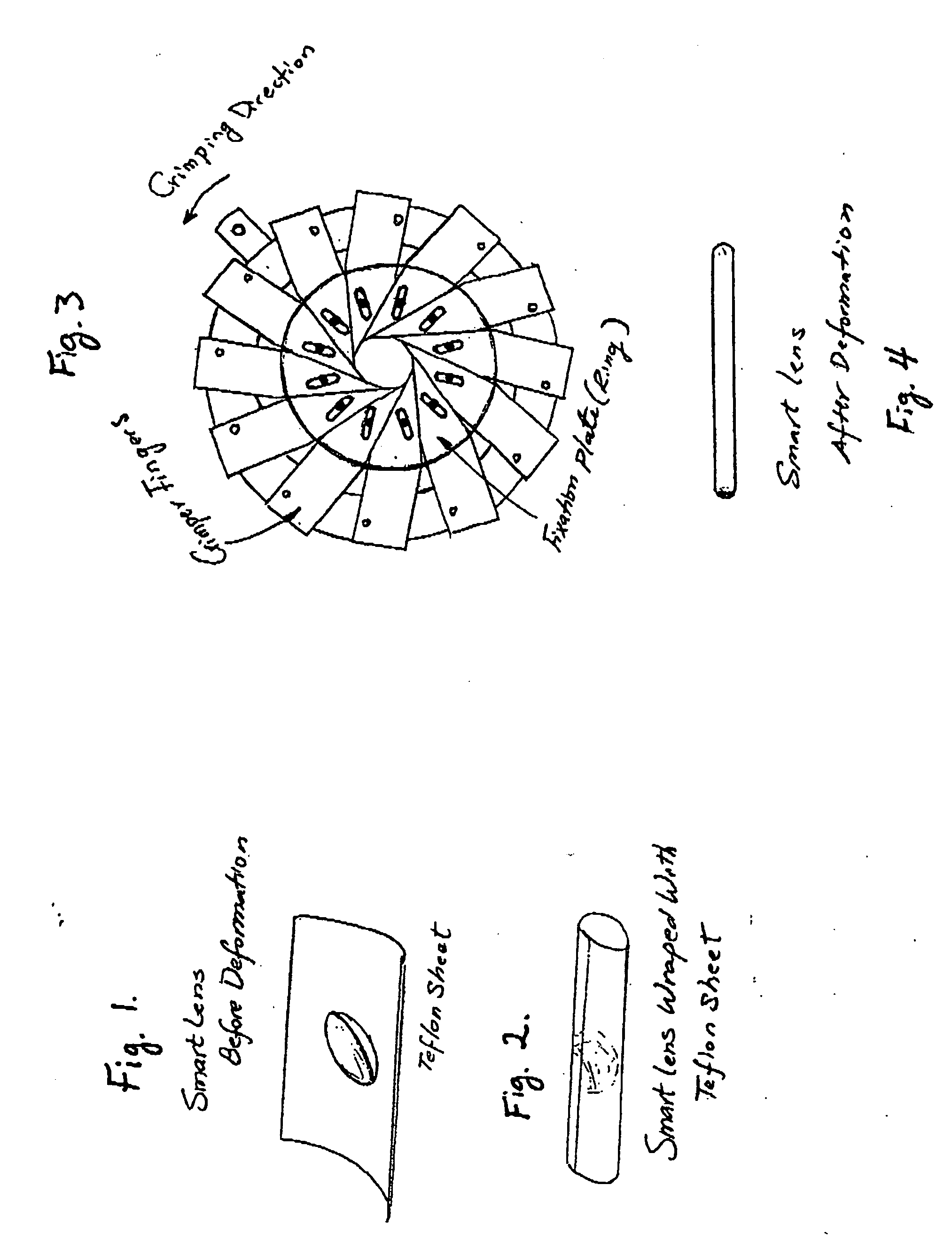 Apparatus and method for implanting intraocular lens through a small incision