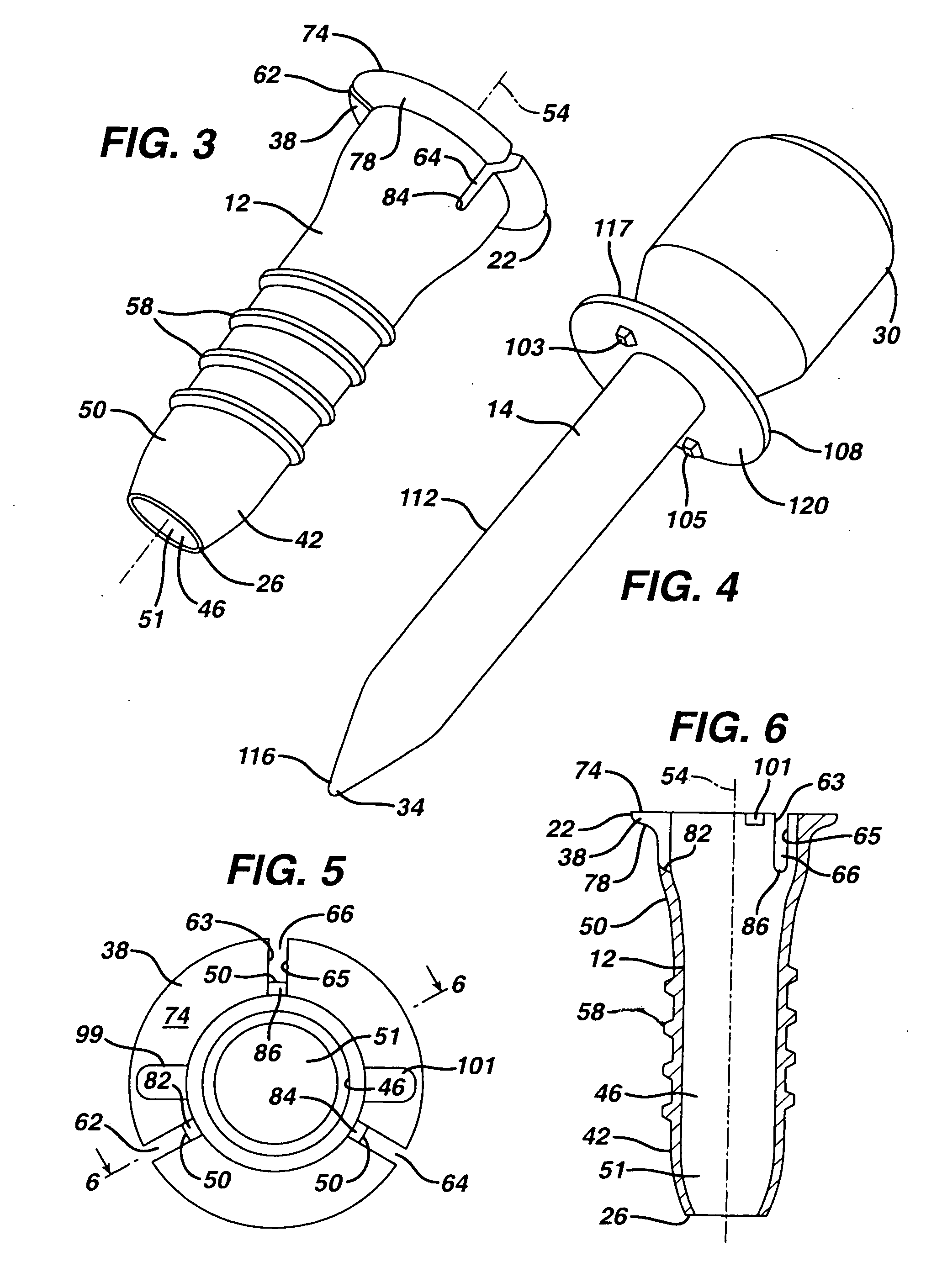 Method of delivering therapeutic implant