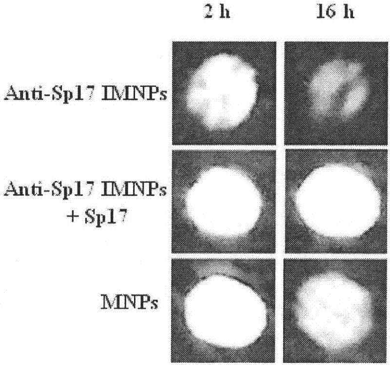 In vivo tumor imaging target molecule and specific probe thereof