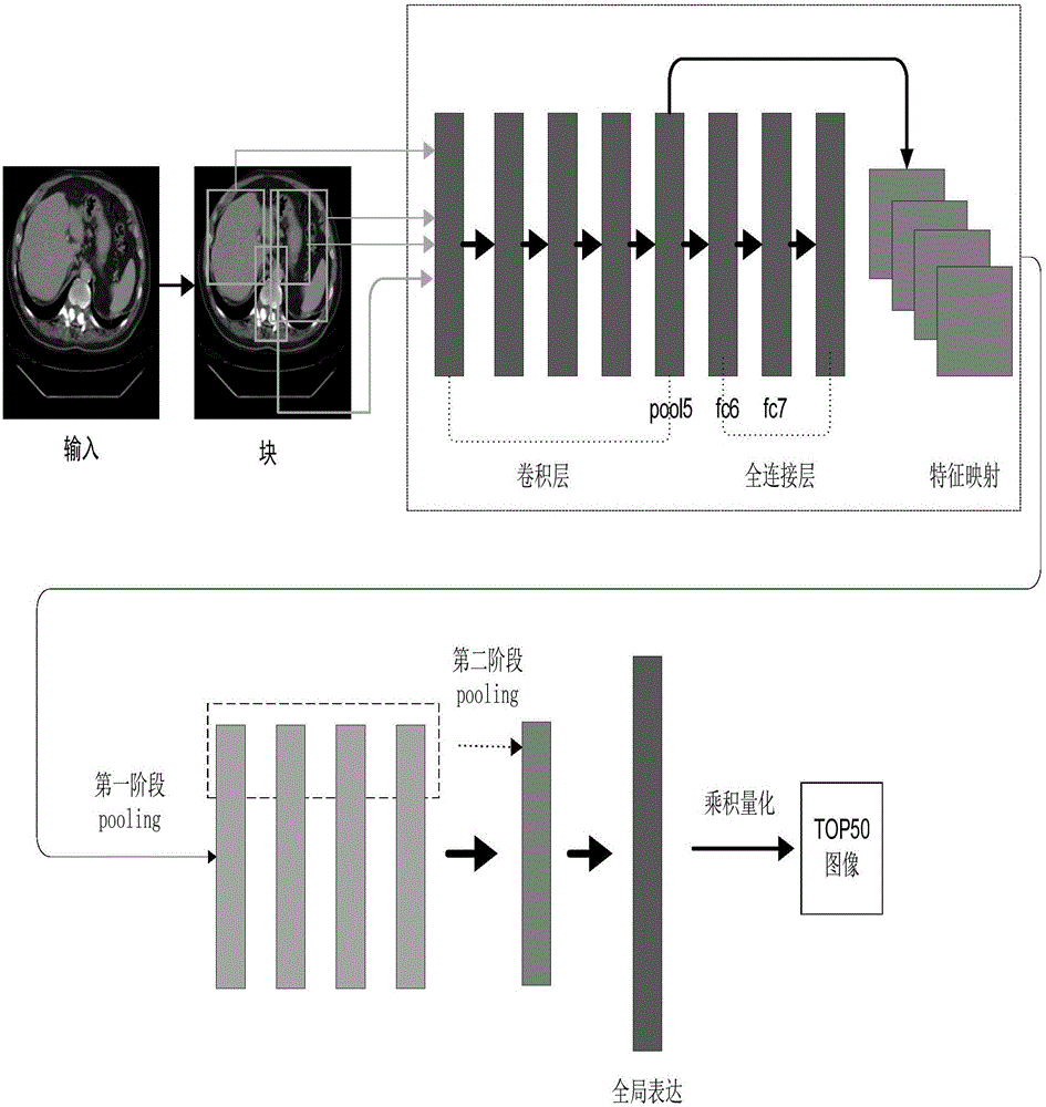Medical image retrieval method based on deep learning and Radon conversion