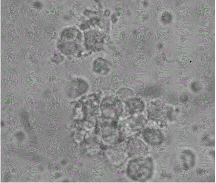 Brucella L7/L12 protein antigen epitope polypeptides and application thereof