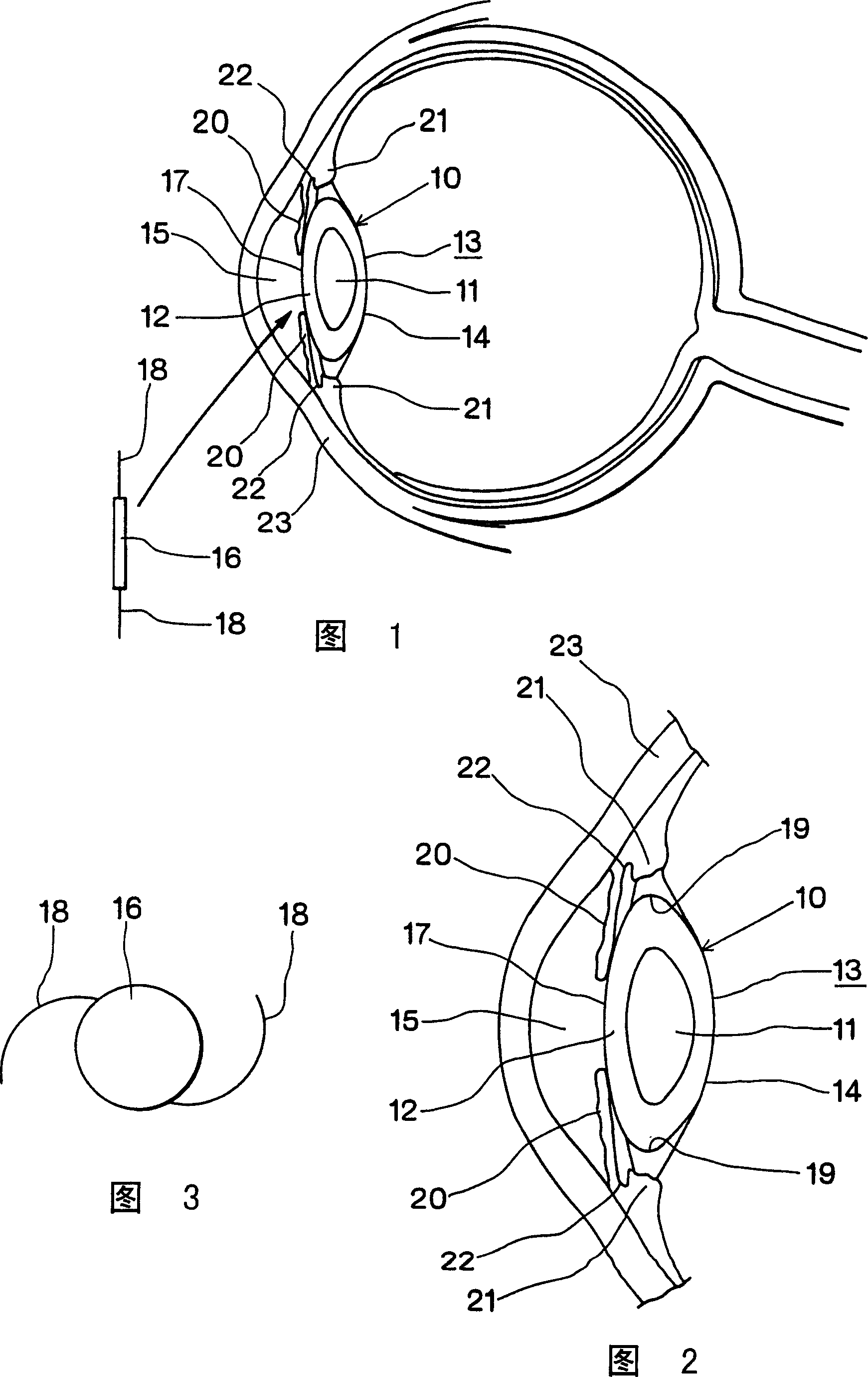 Device for implanting lens into eye