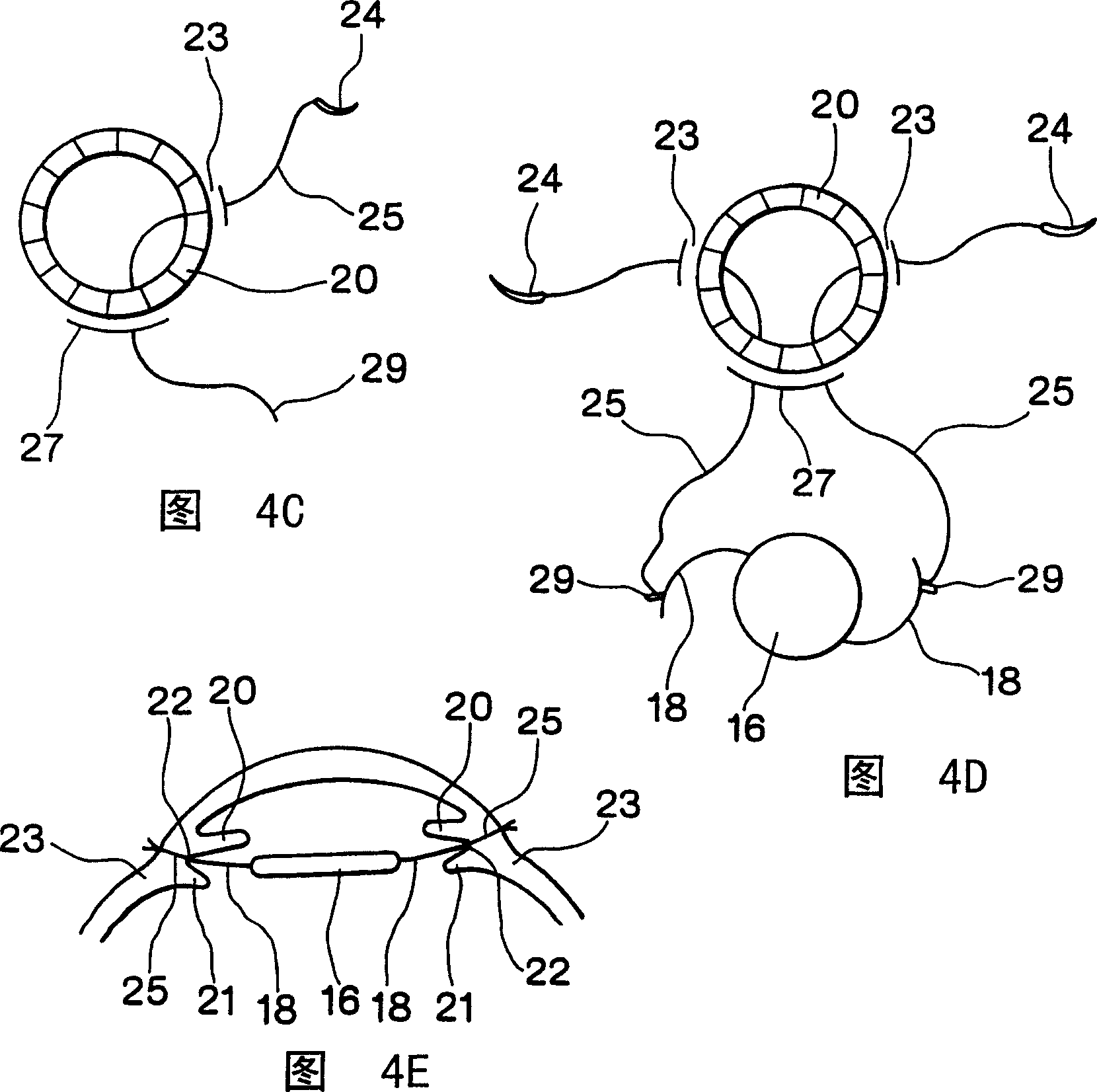 Device for implanting lens into eye
