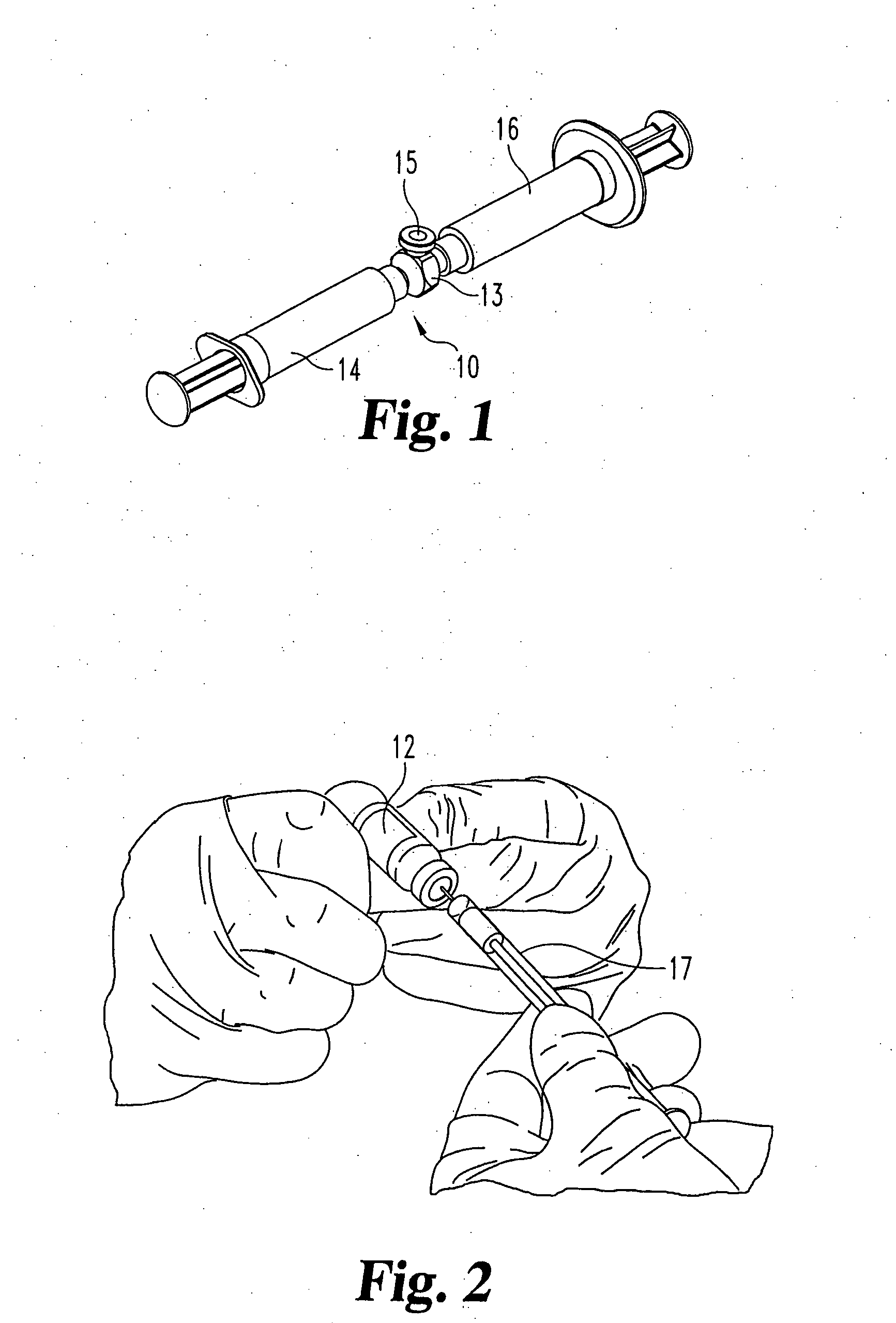 Methods for treating defects and injuries of an intervertebral disc