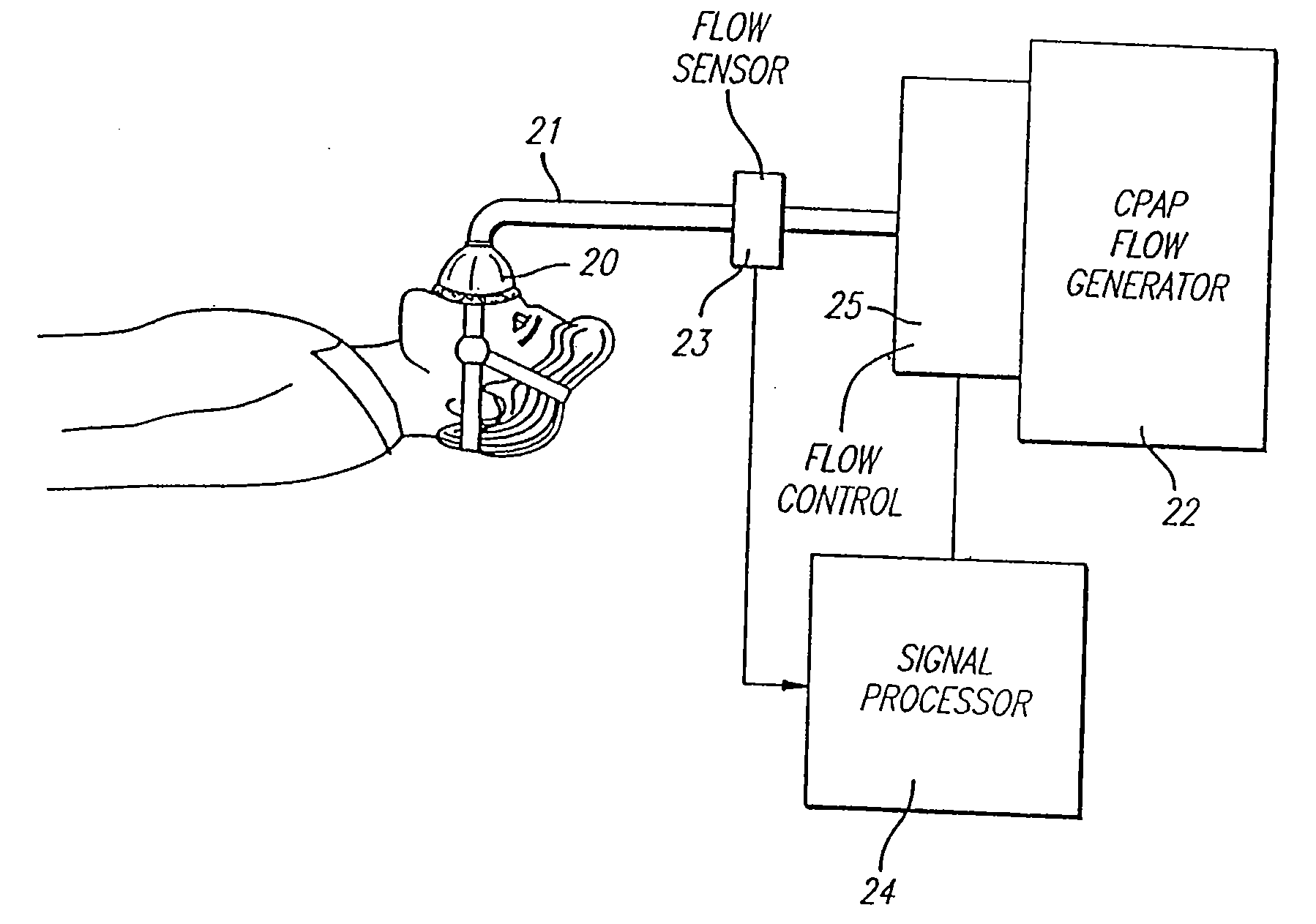 Method and Apparatus for Optimizing the Continuous Positive Airway Pressure for Treating Obstructive Sleep Apnea