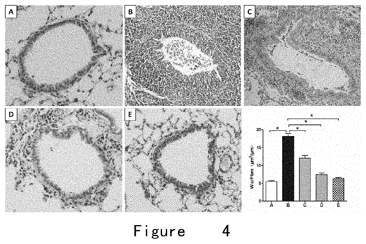 Exosome preparation for treating disease and application thereof