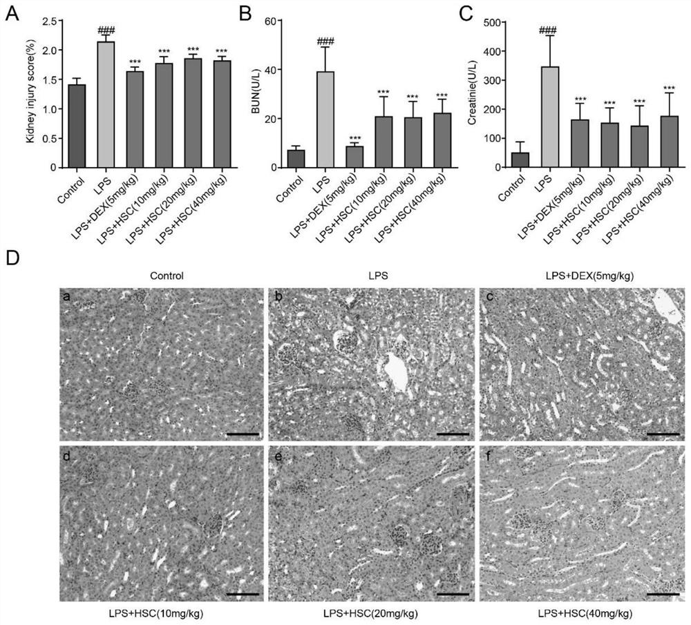 Application of Hedraaponin C in preparation of medicine for treating and preventing acute kidney injury