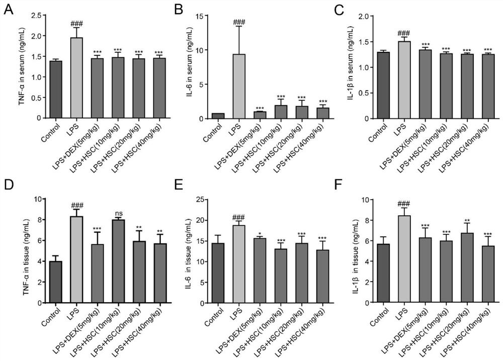 Application of Hedraaponin C in preparation of medicine for treating and preventing acute kidney injury