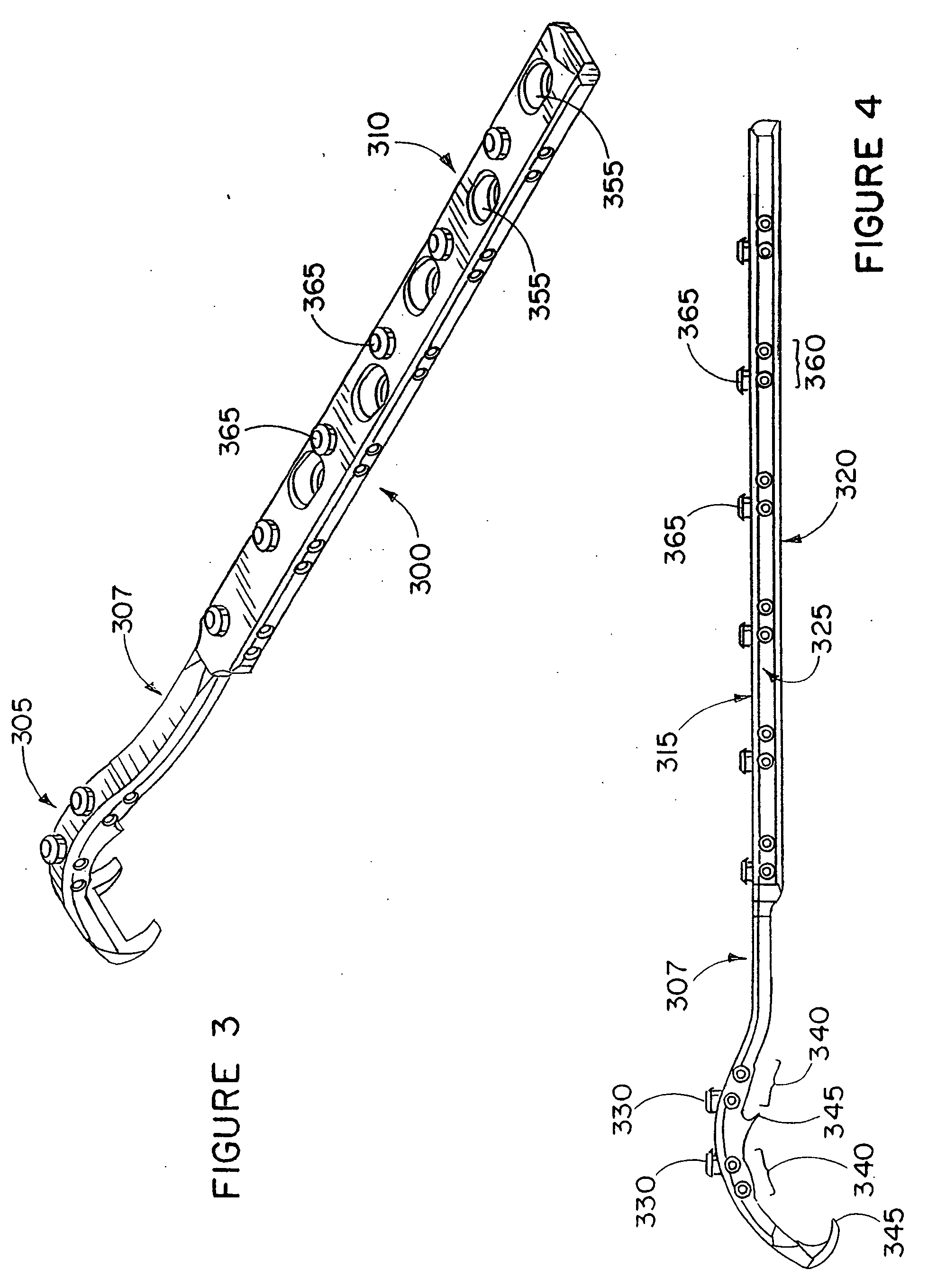 Apparatus and method for repairing the femur