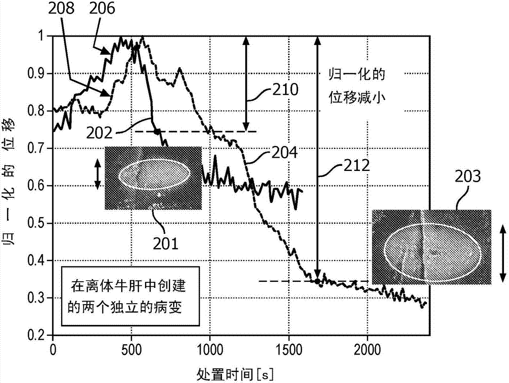 System and method for adaptive ablation and therapy based on elastography monitoring