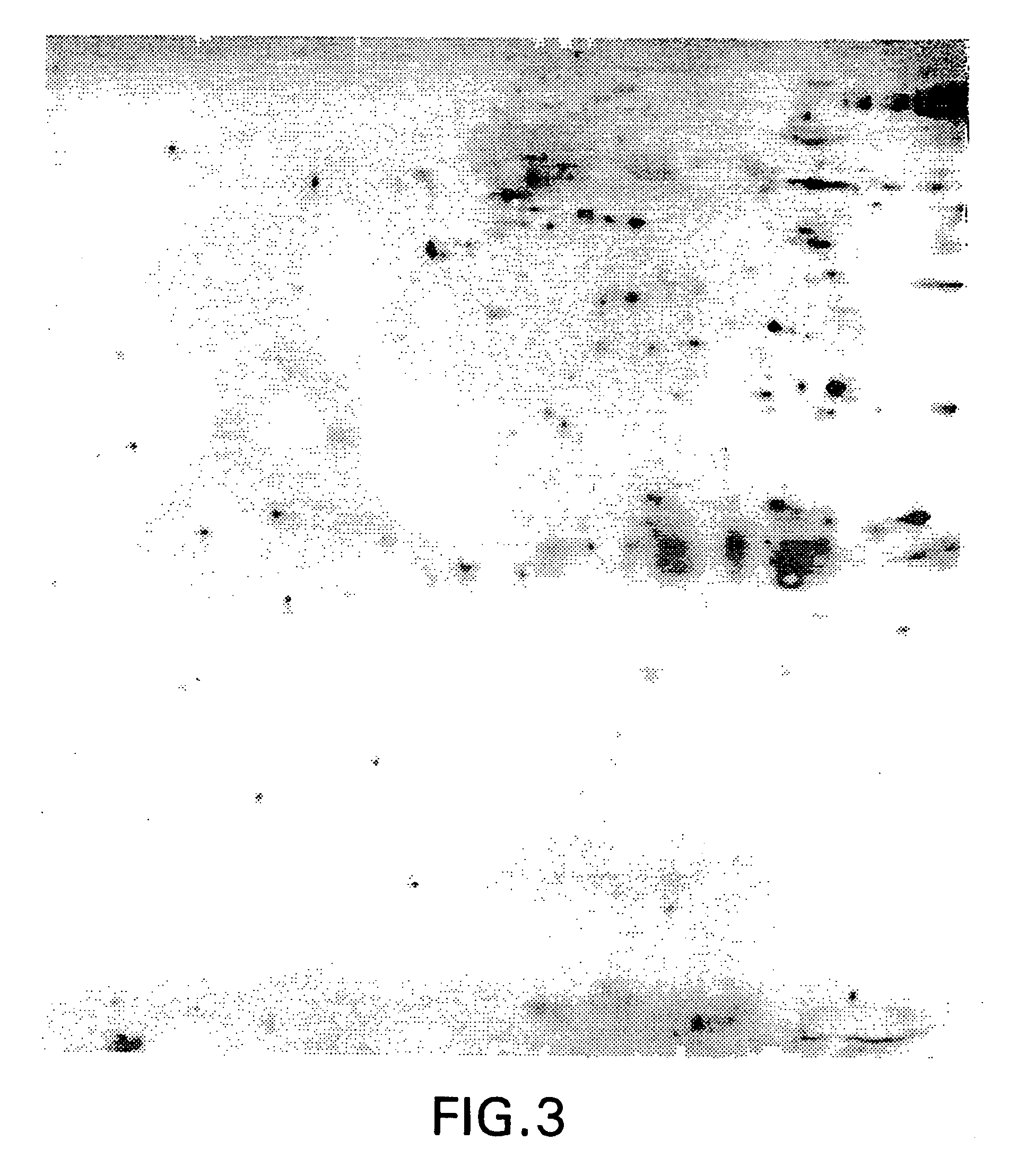 Method for identification of cellular protein antigens and presence of antibodies to specific cellular protein antigens in serum
