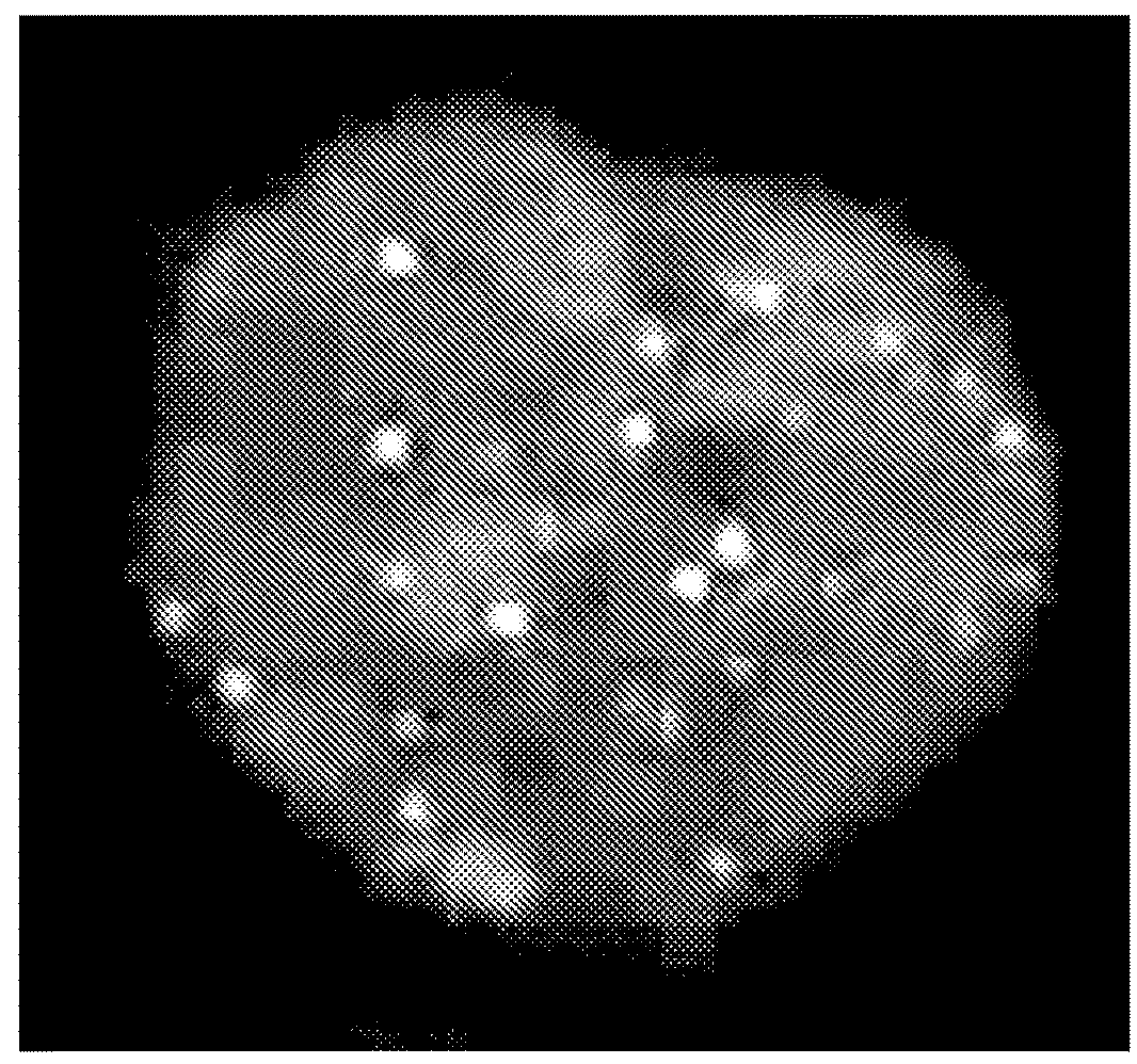 Hematological disorder diagnosis by 3D q-FISH